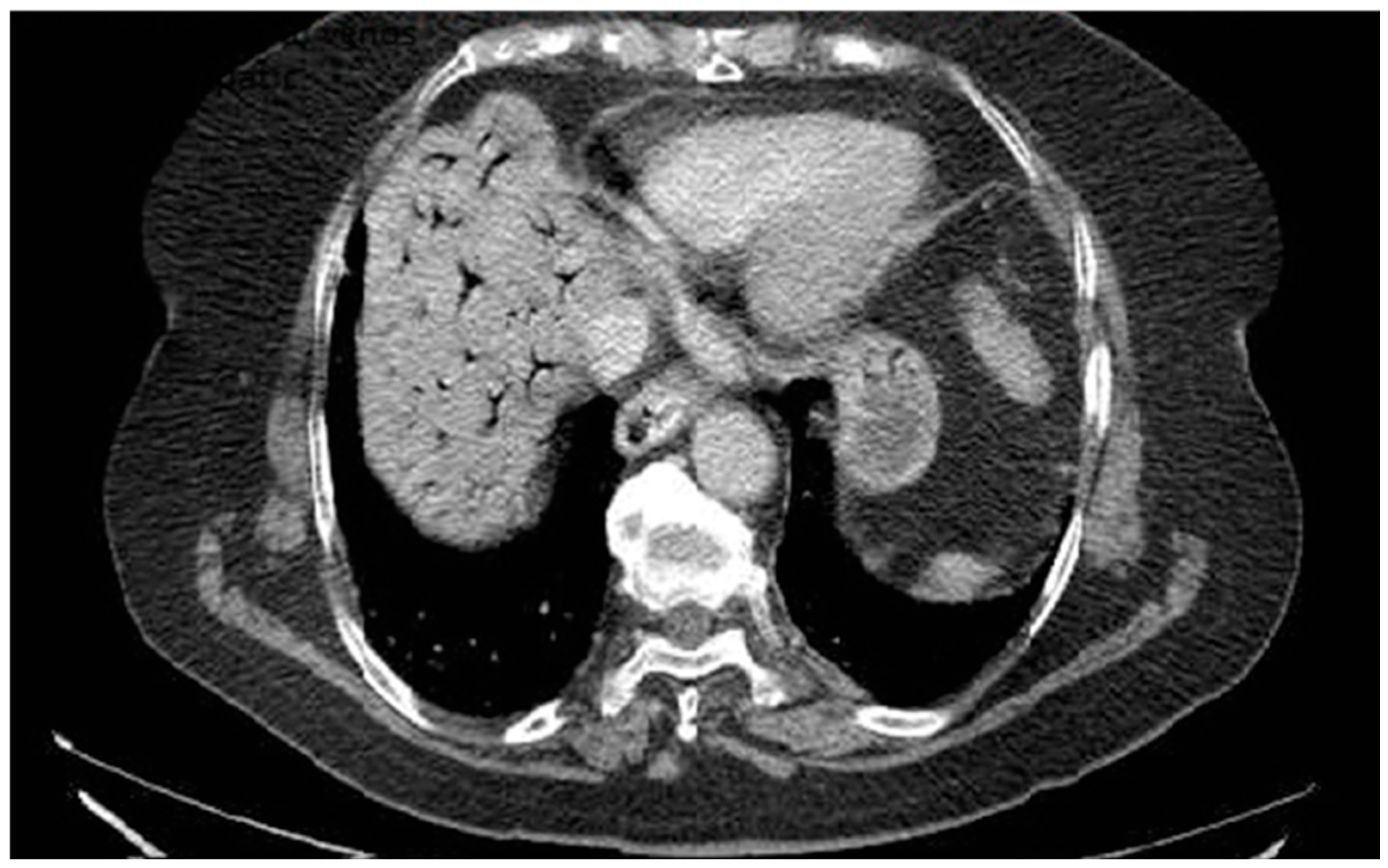 Diagnostics 16 00800 g002