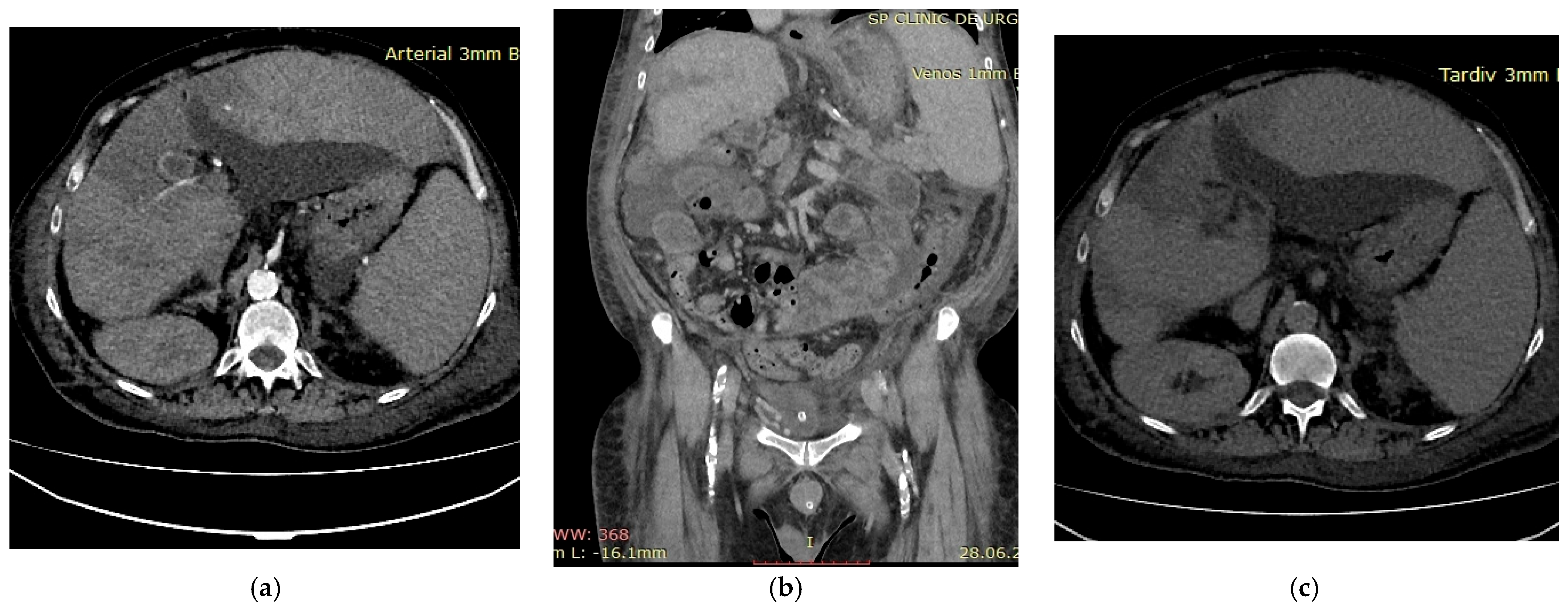 Diagnostics 16 00800 g003
