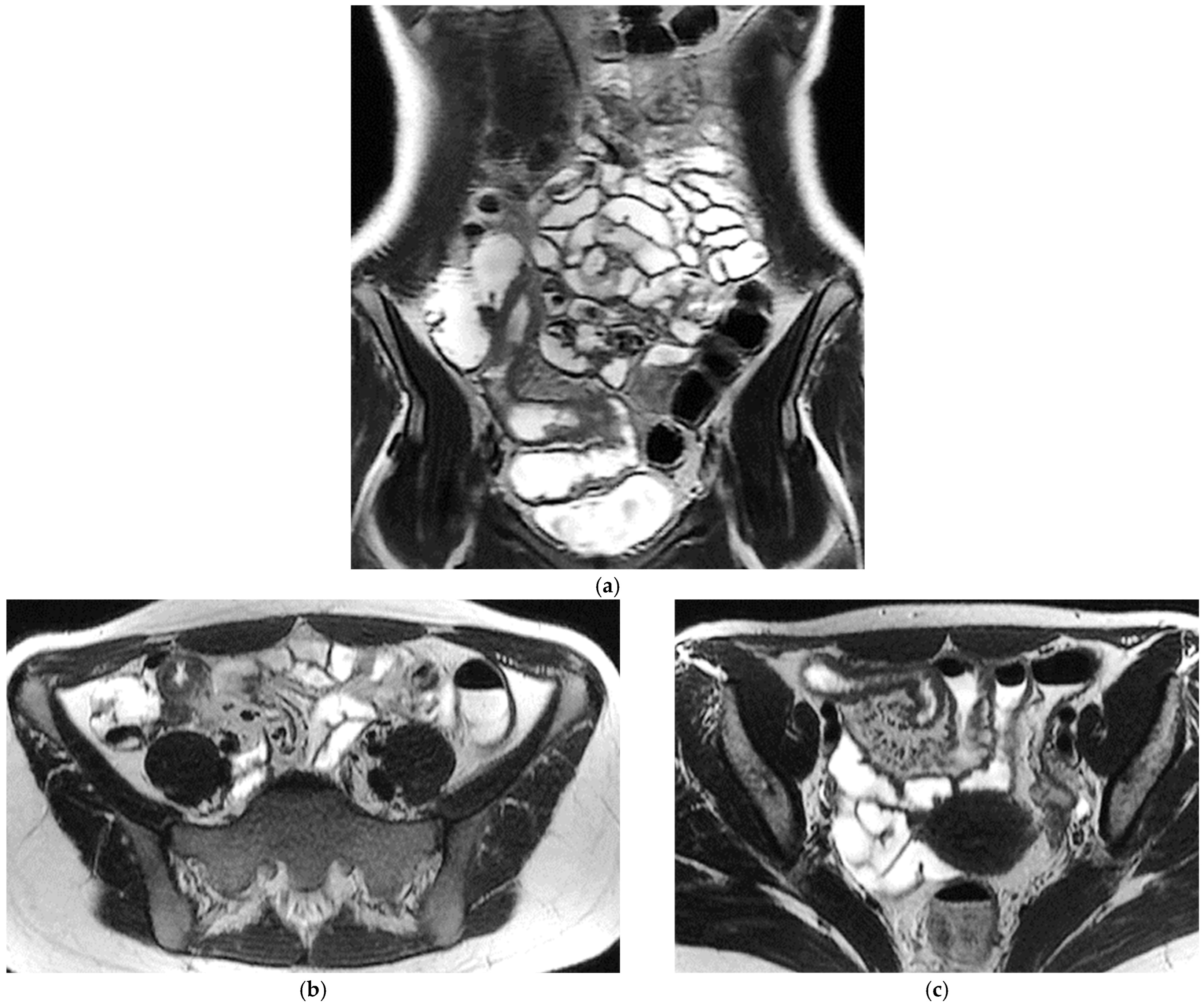 Diagnostics 16 00882 g001a