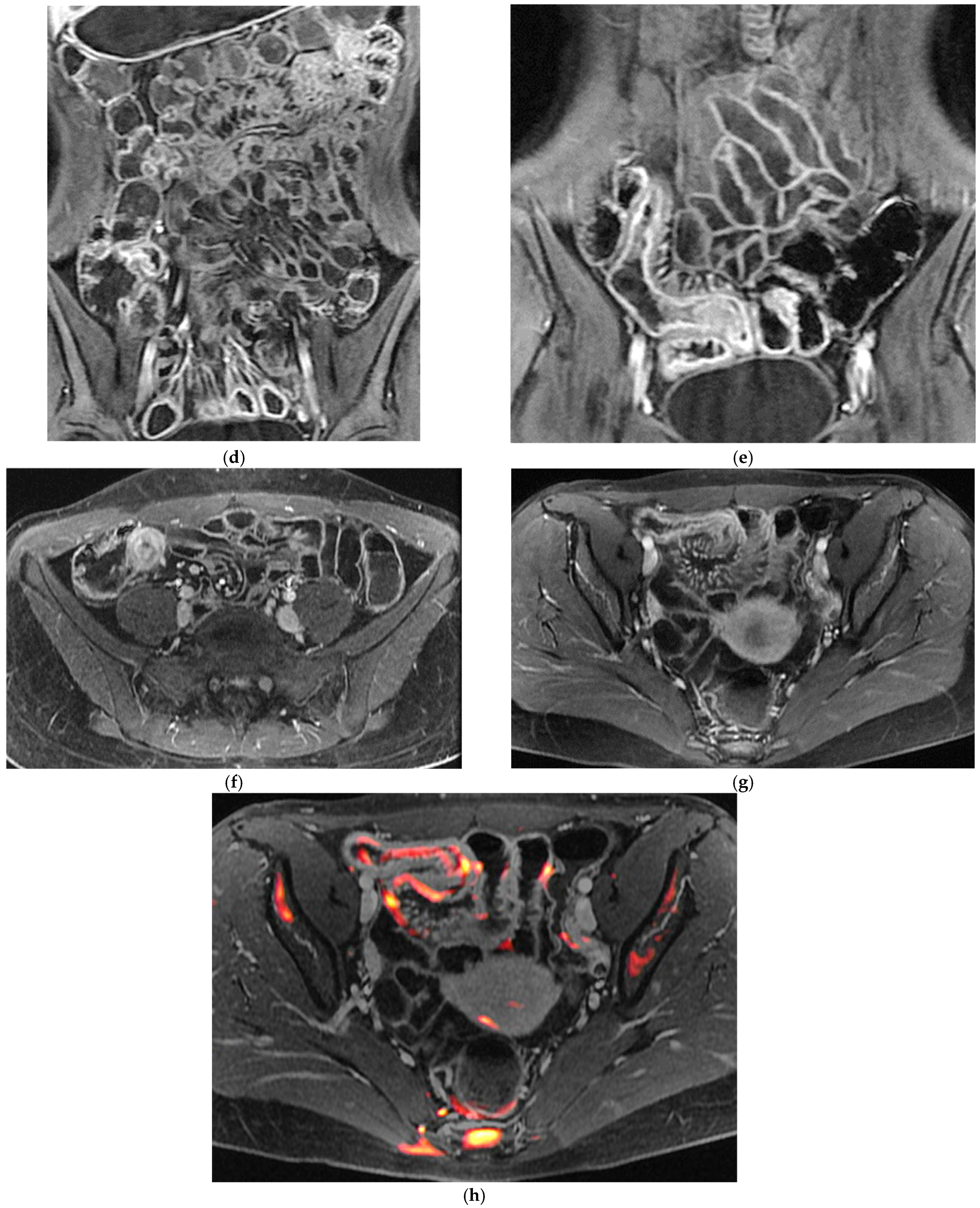 Diagnostics 16 00882 g001b