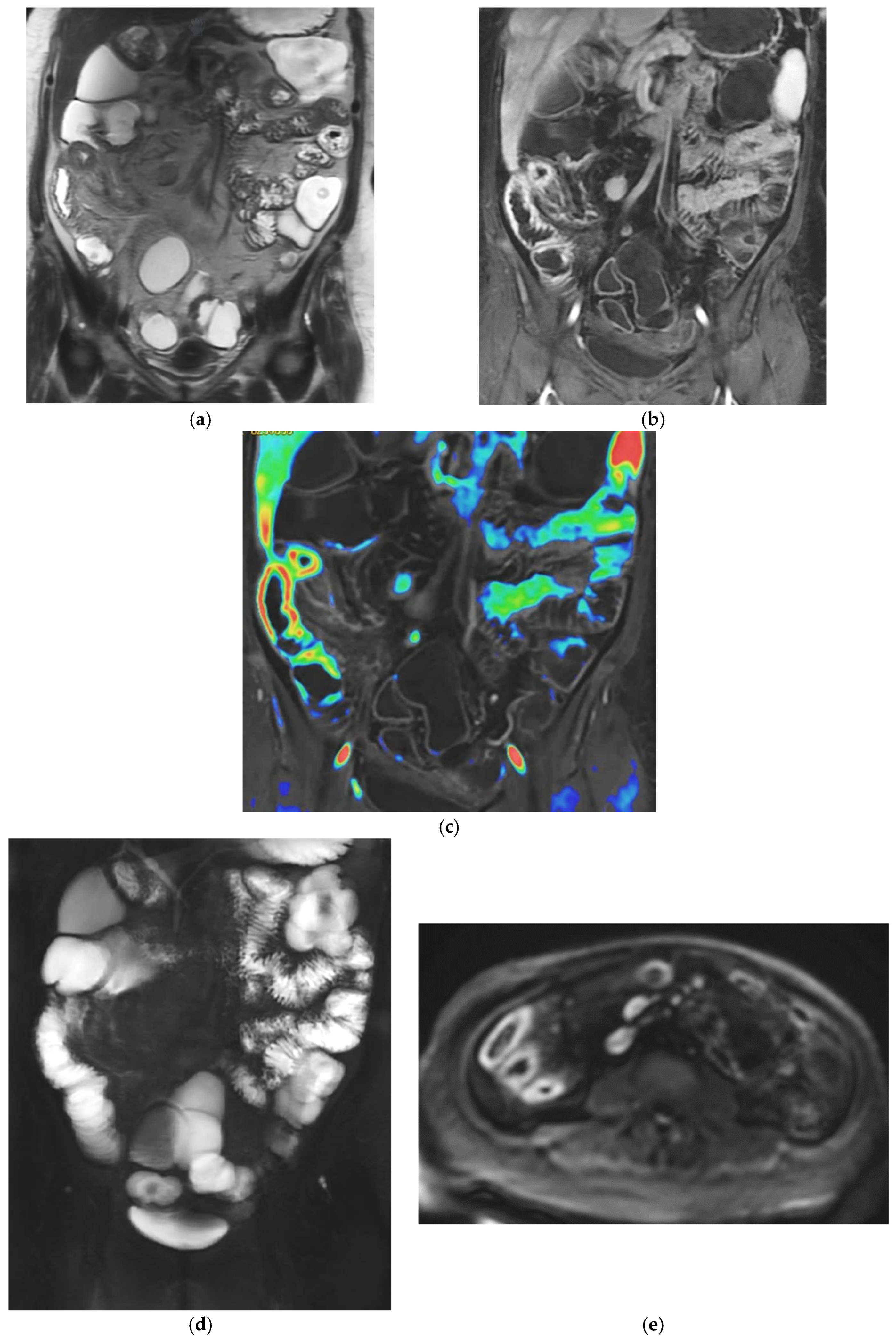 Diagnostics 16 00882 g002