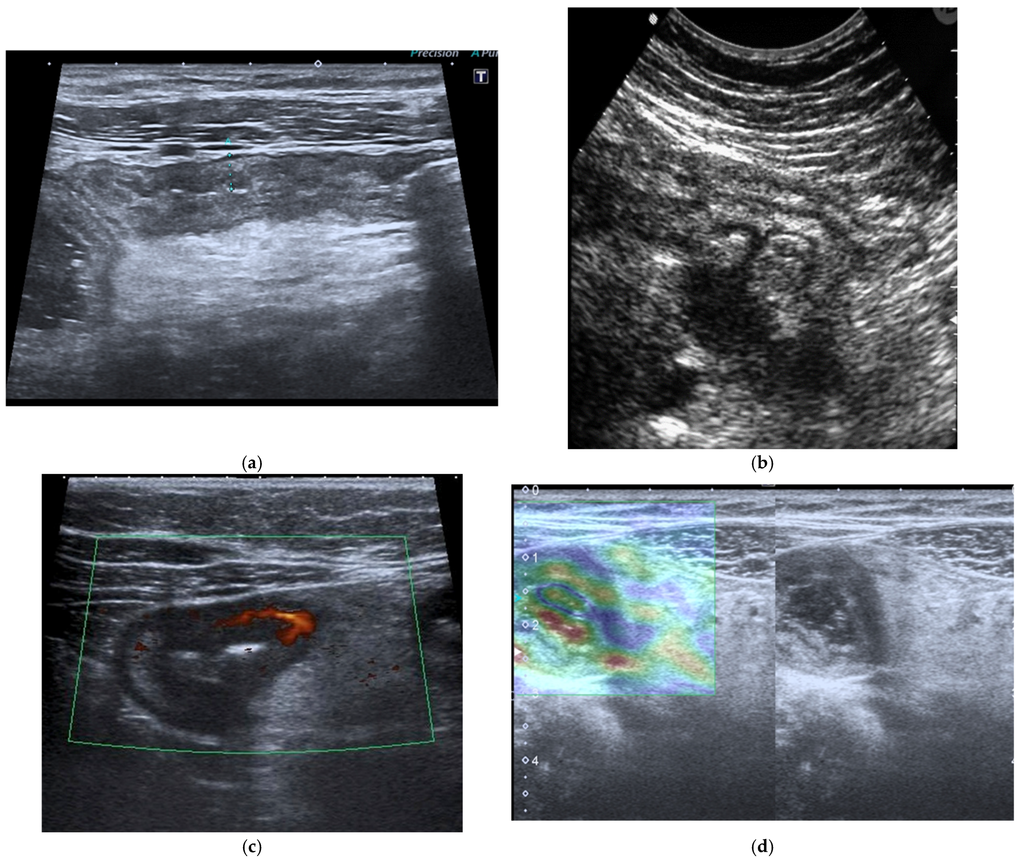 Diagnostics 16 00882 g003