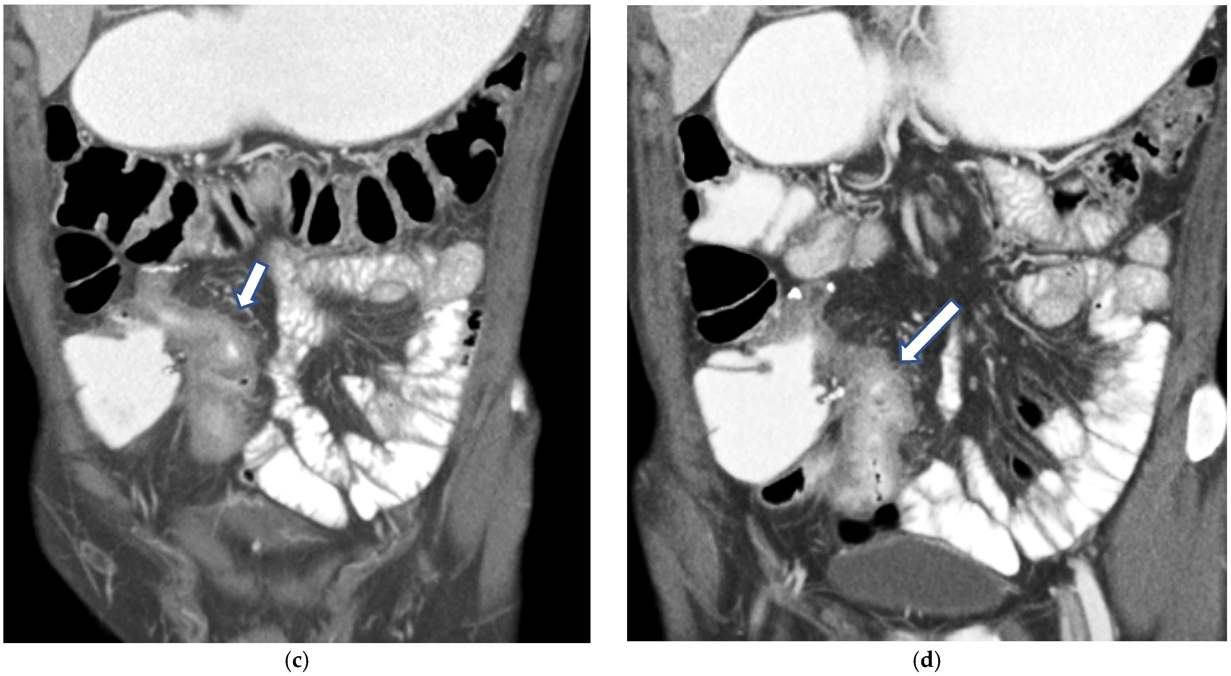 Diagnostics 16 00882 g004b