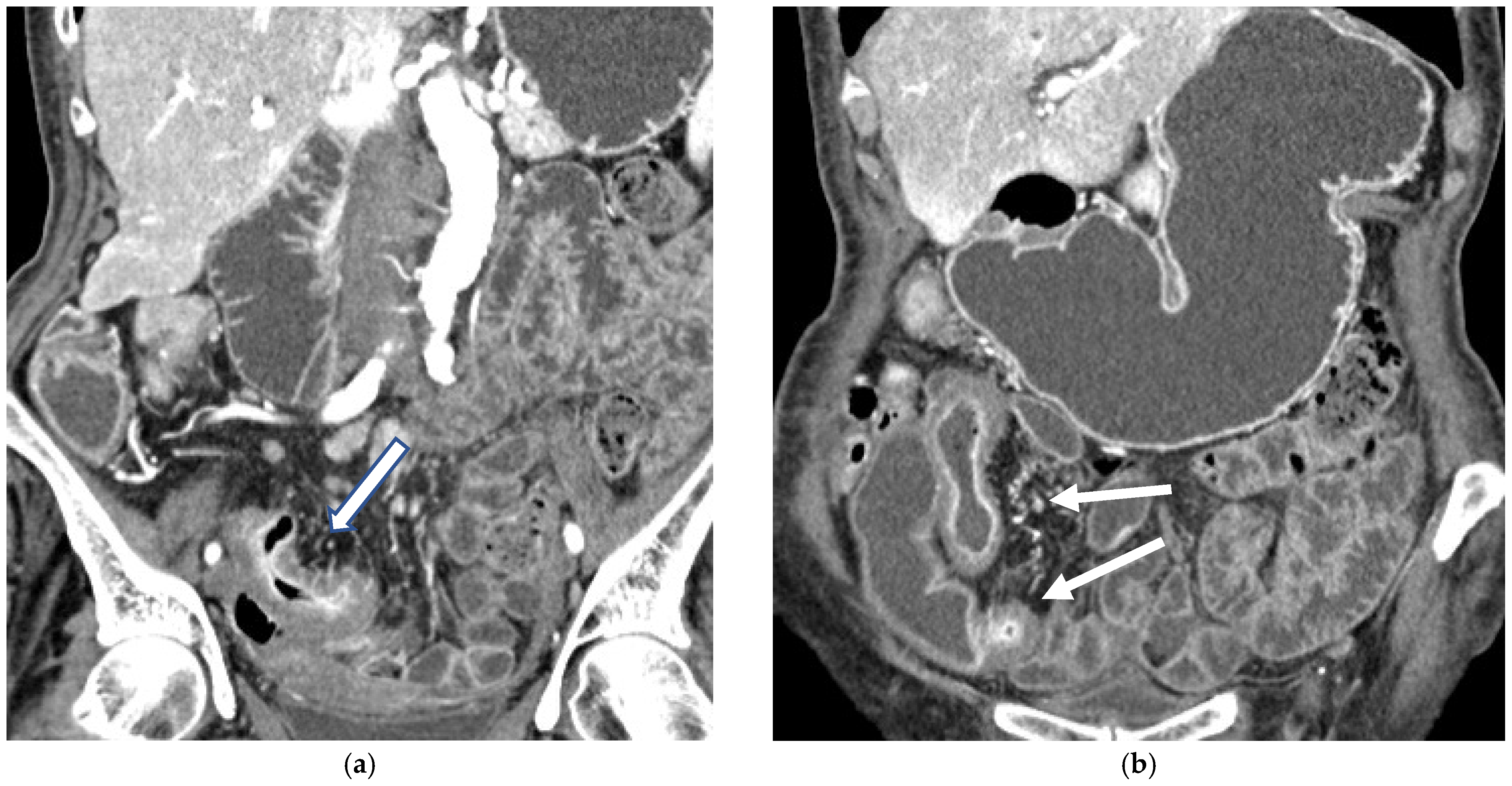 Diagnostics 16 00882 g005a