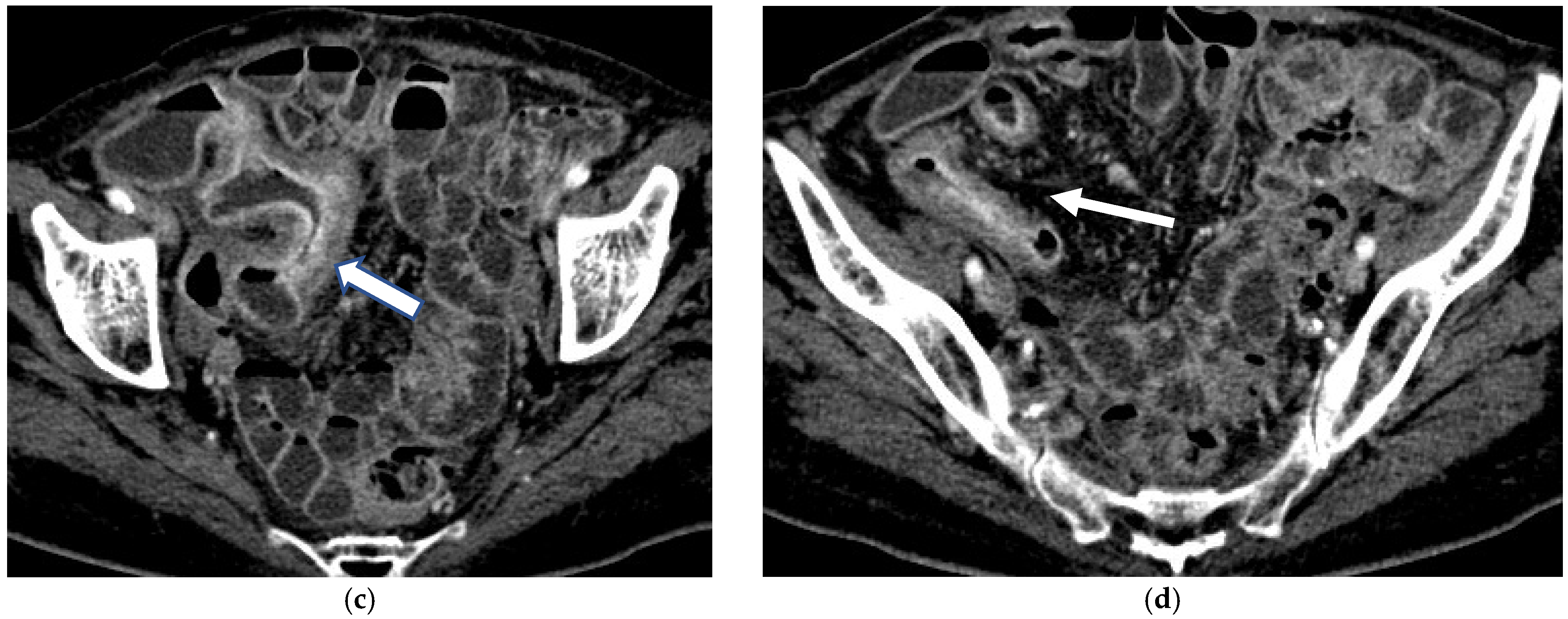 Diagnostics 16 00882 g005b