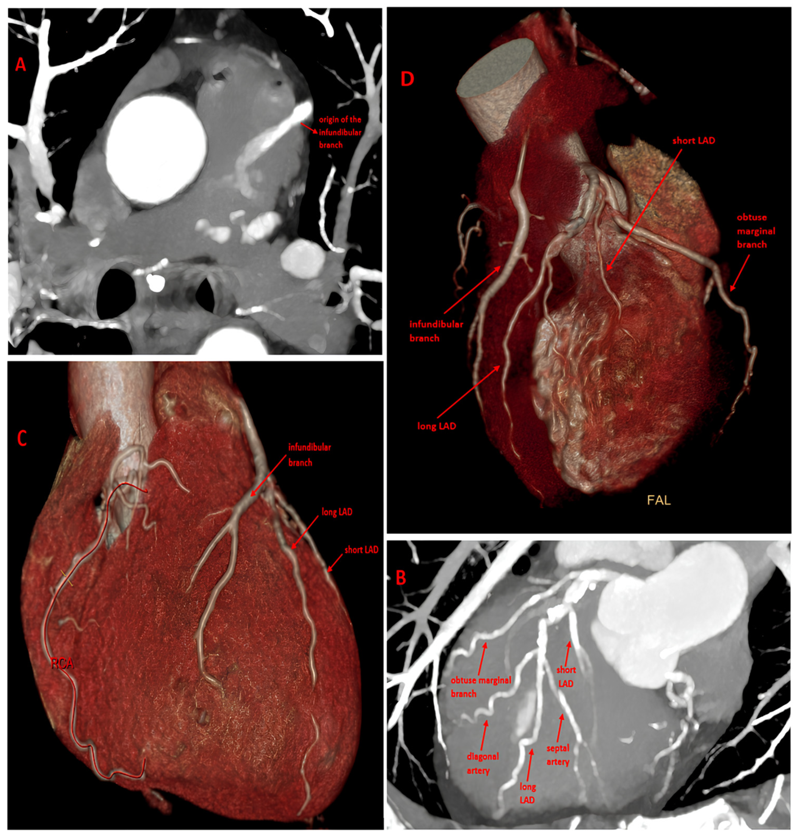 Diagnostics 16 00886 g001
