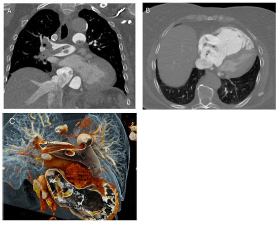 Diagnostics 16 00917 g001