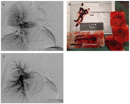 Diagnostics 16 00917 g003