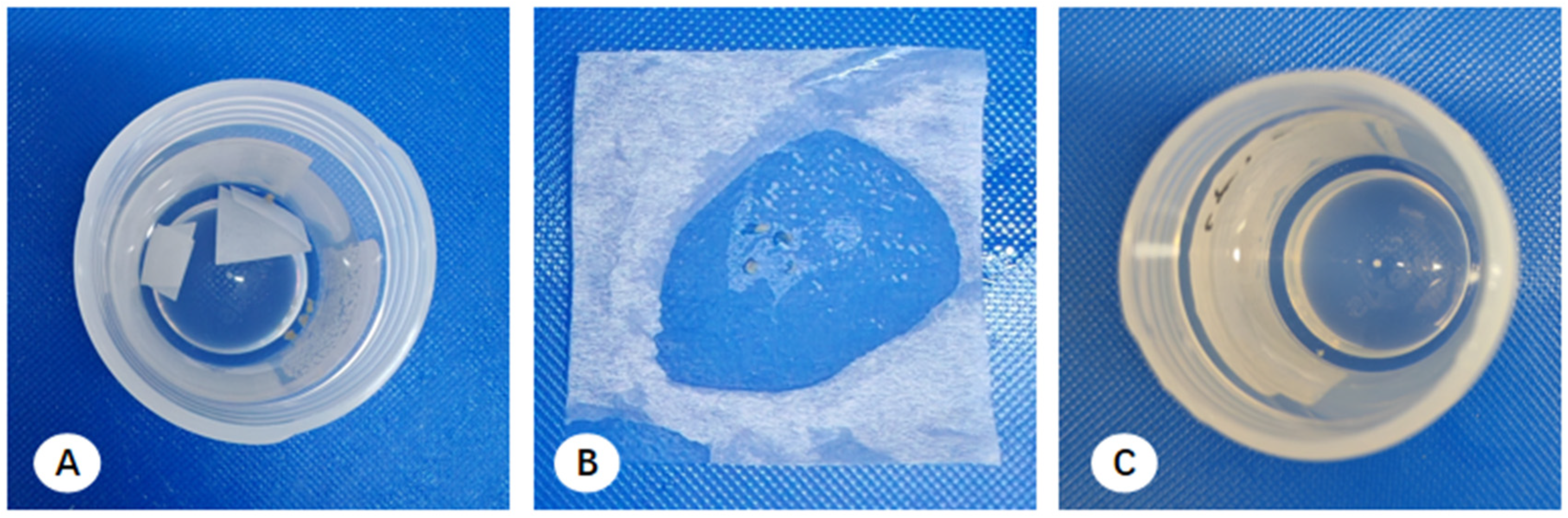 Diagnostics 16 00962 g001