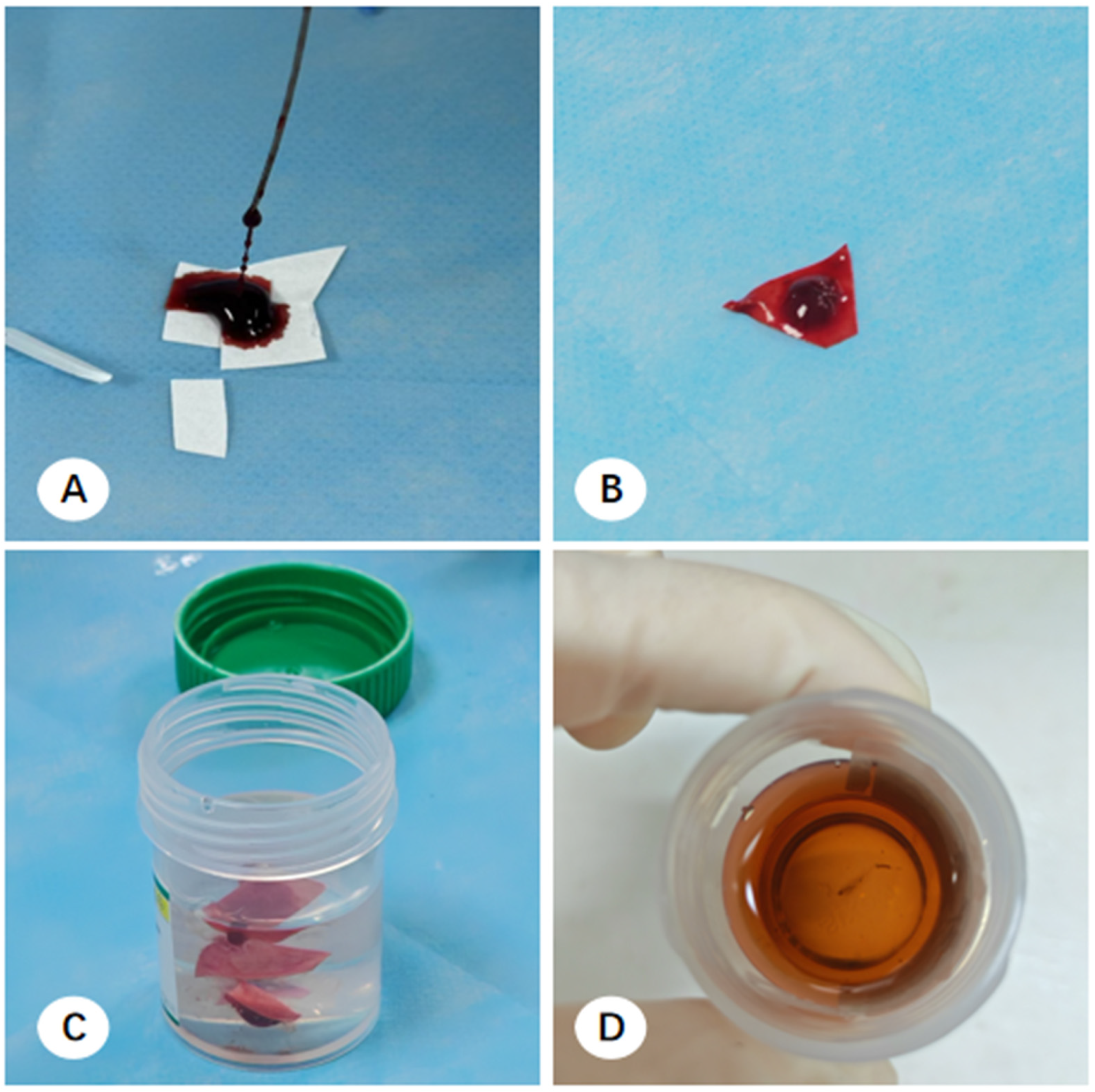 Diagnostics 16 00962 g004