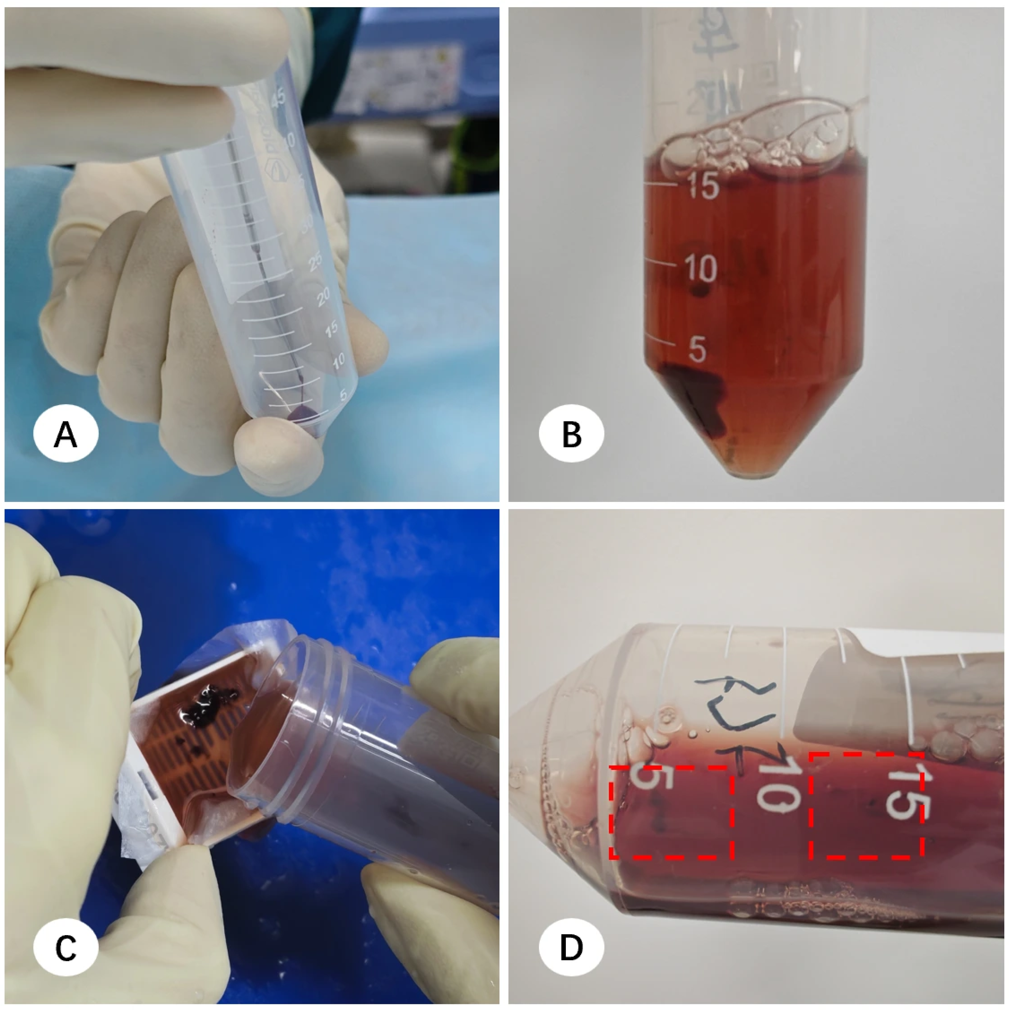 Diagnostics 16 00962 g005