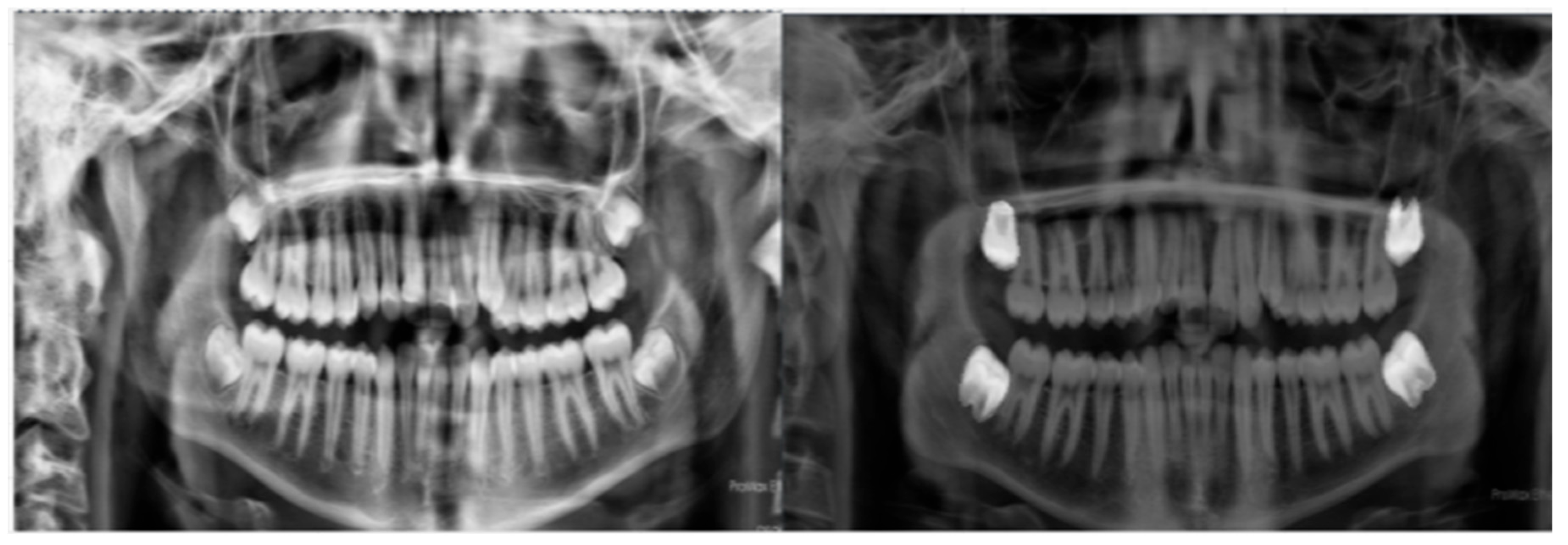 Diagnostics 16 00977 g001 Diagnostics 16 00977 g001