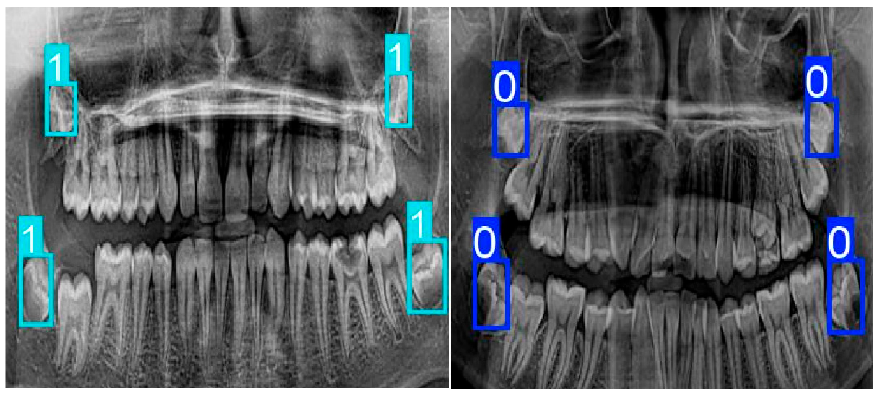 Diagnostics 16 00977 g002 Diagnostics 16 00977 g002