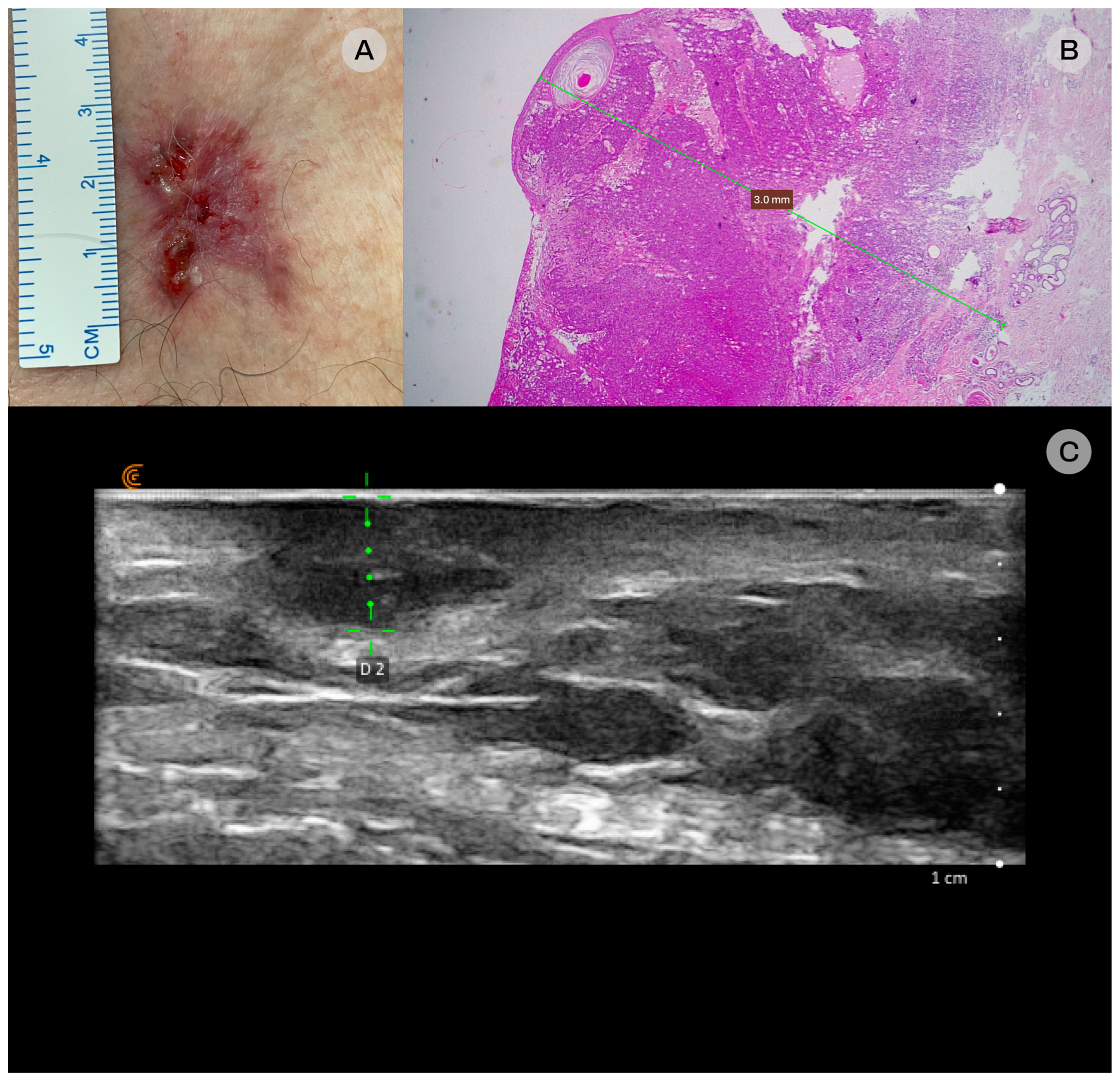 Diagnostics 16 00978 g001 Diagnostics 16 00978 g001