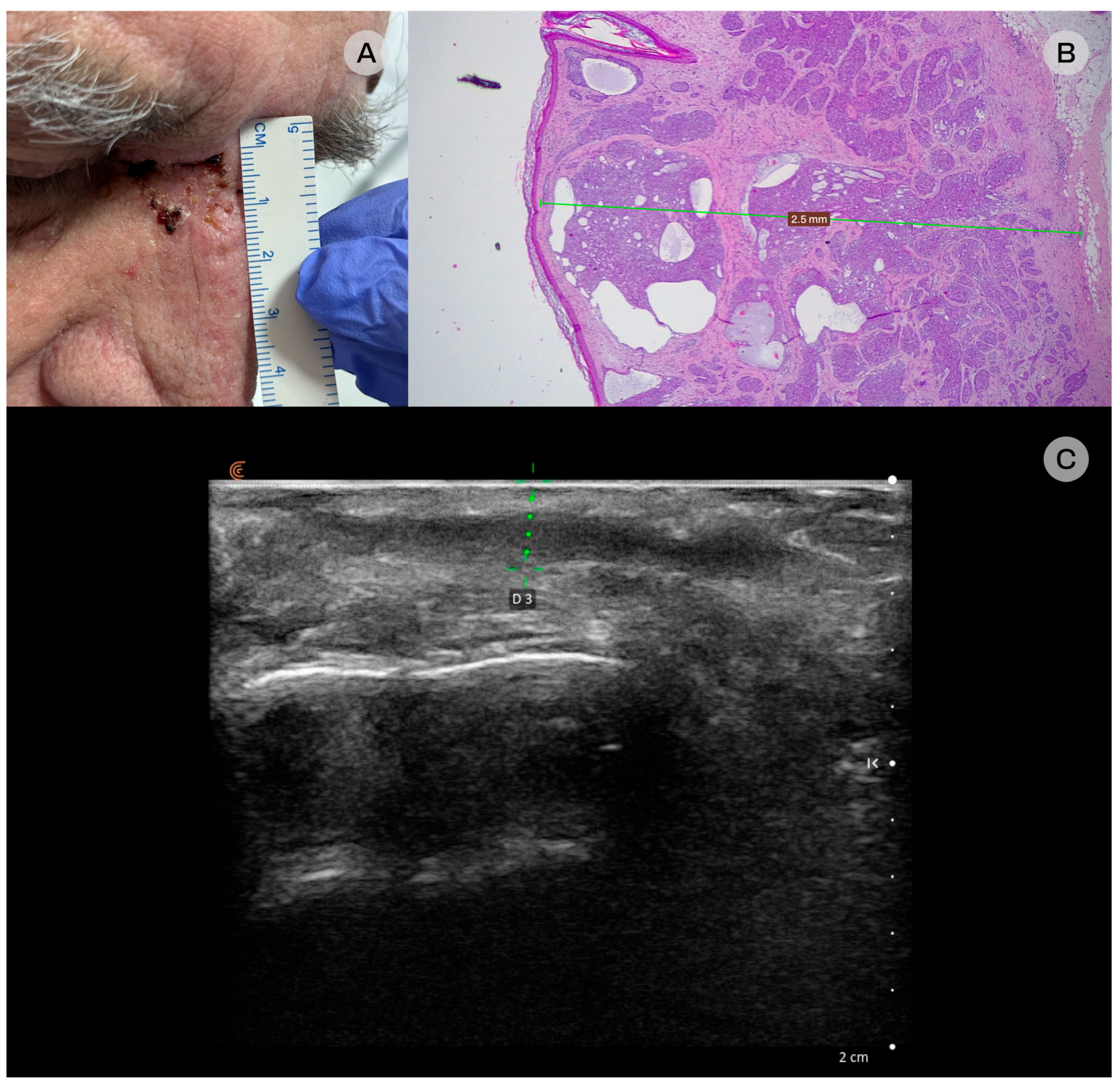 Diagnostics 16 00978 g003 Diagnostics 16 00978 g003