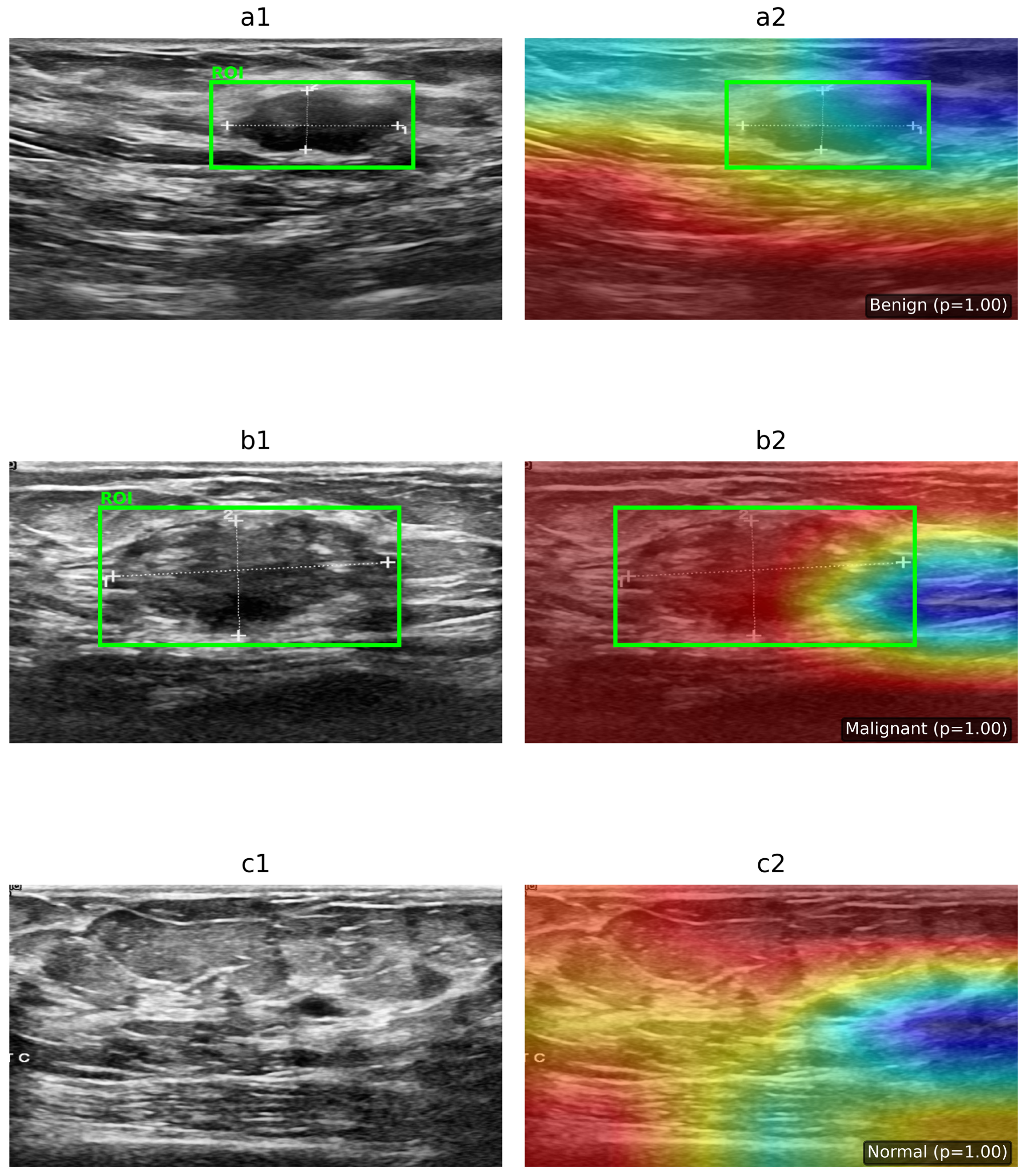 Diagnostics 16 01176 g006 Diagnostics 16 01176 g006