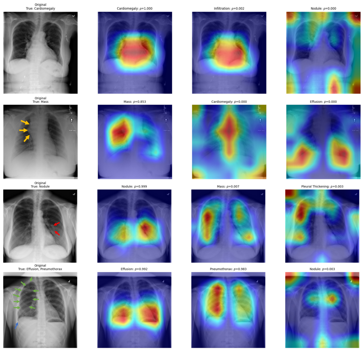 Diagnostics 16 01227 g006 Diagnostics 16 01227 g006