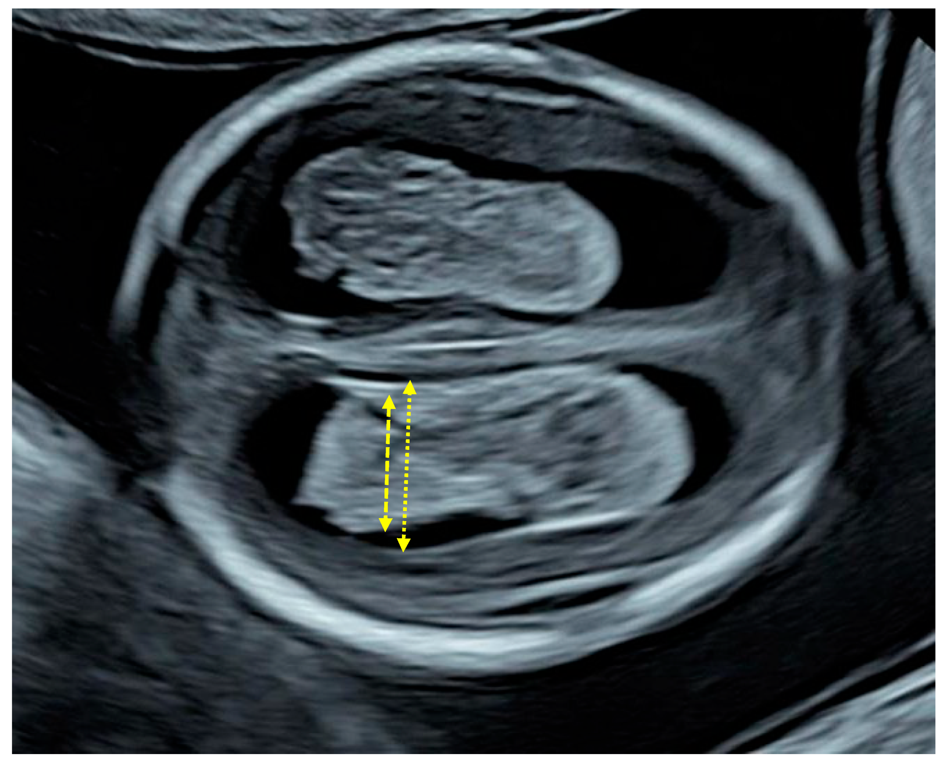 Diagnostics 16 01302 g001 Diagnostics 16 01302 g001