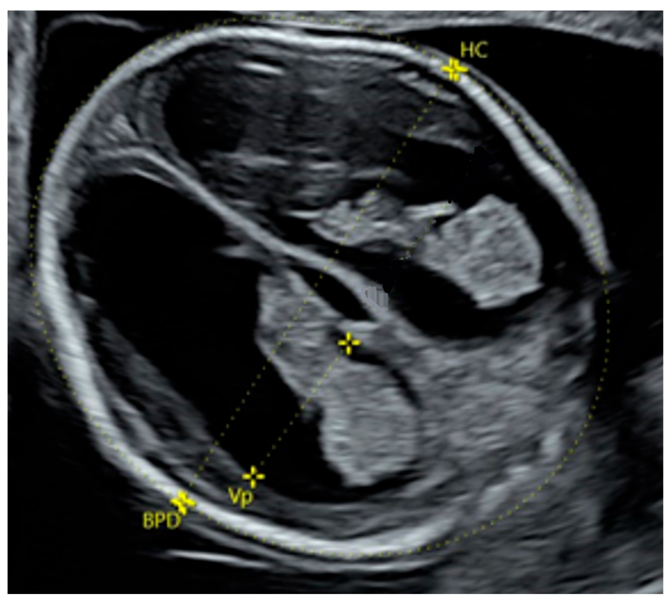 Diagnostics 16 01302 g004 Diagnostics 16 01302 g004