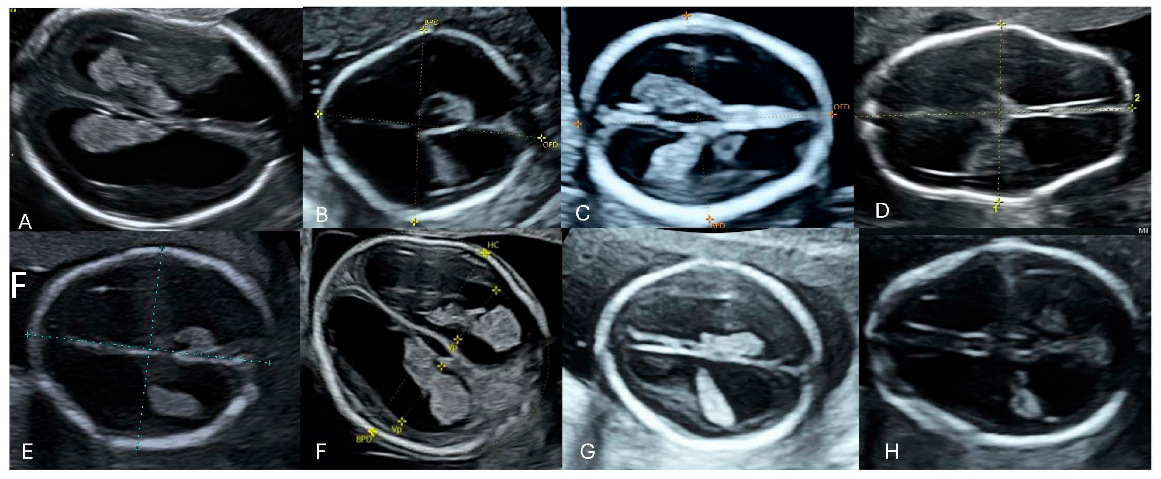 Diagnostics 16 01302 g005 Diagnostics 16 01302 g005