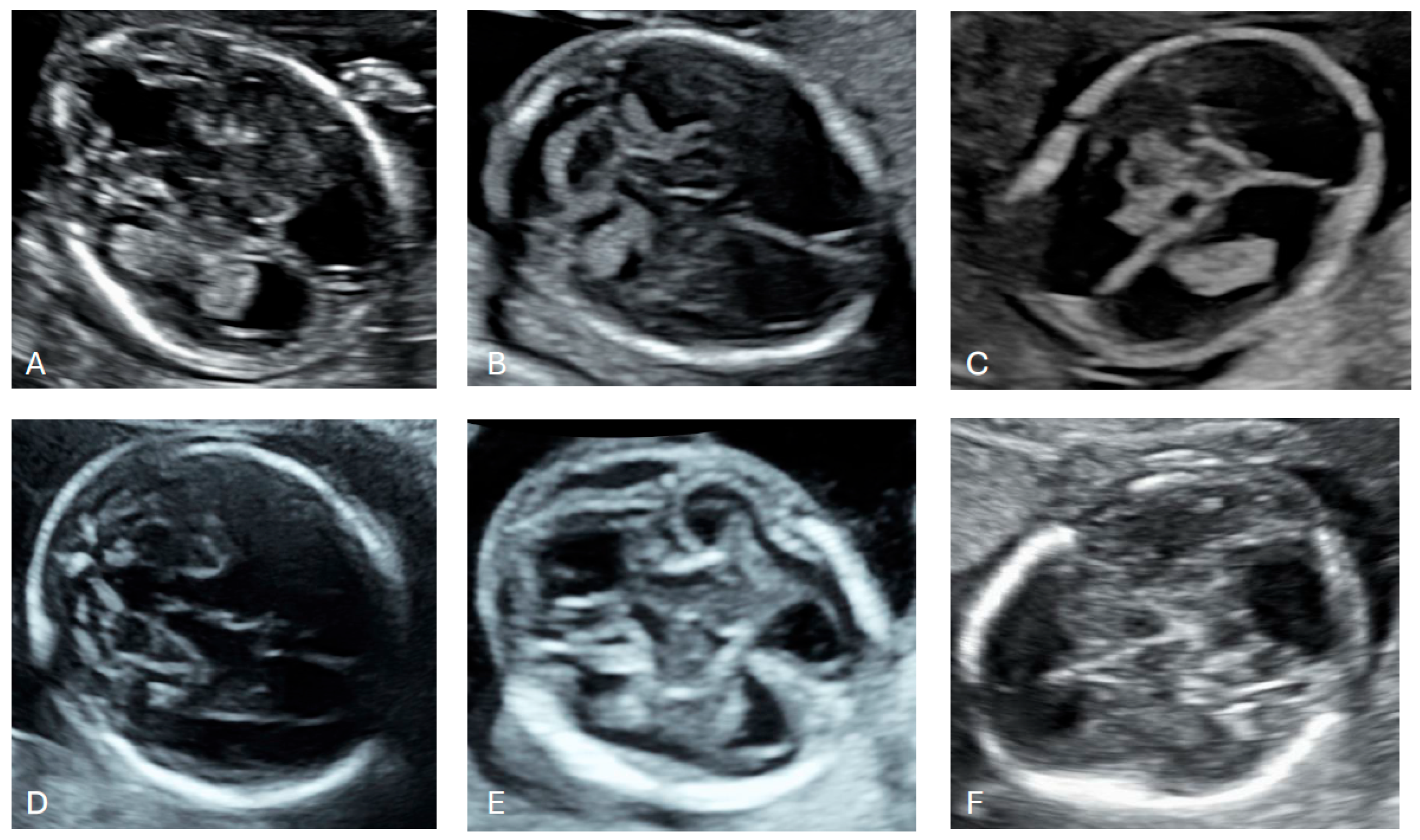 Diagnostics 16 01302 g006 Diagnostics 16 01302 g006