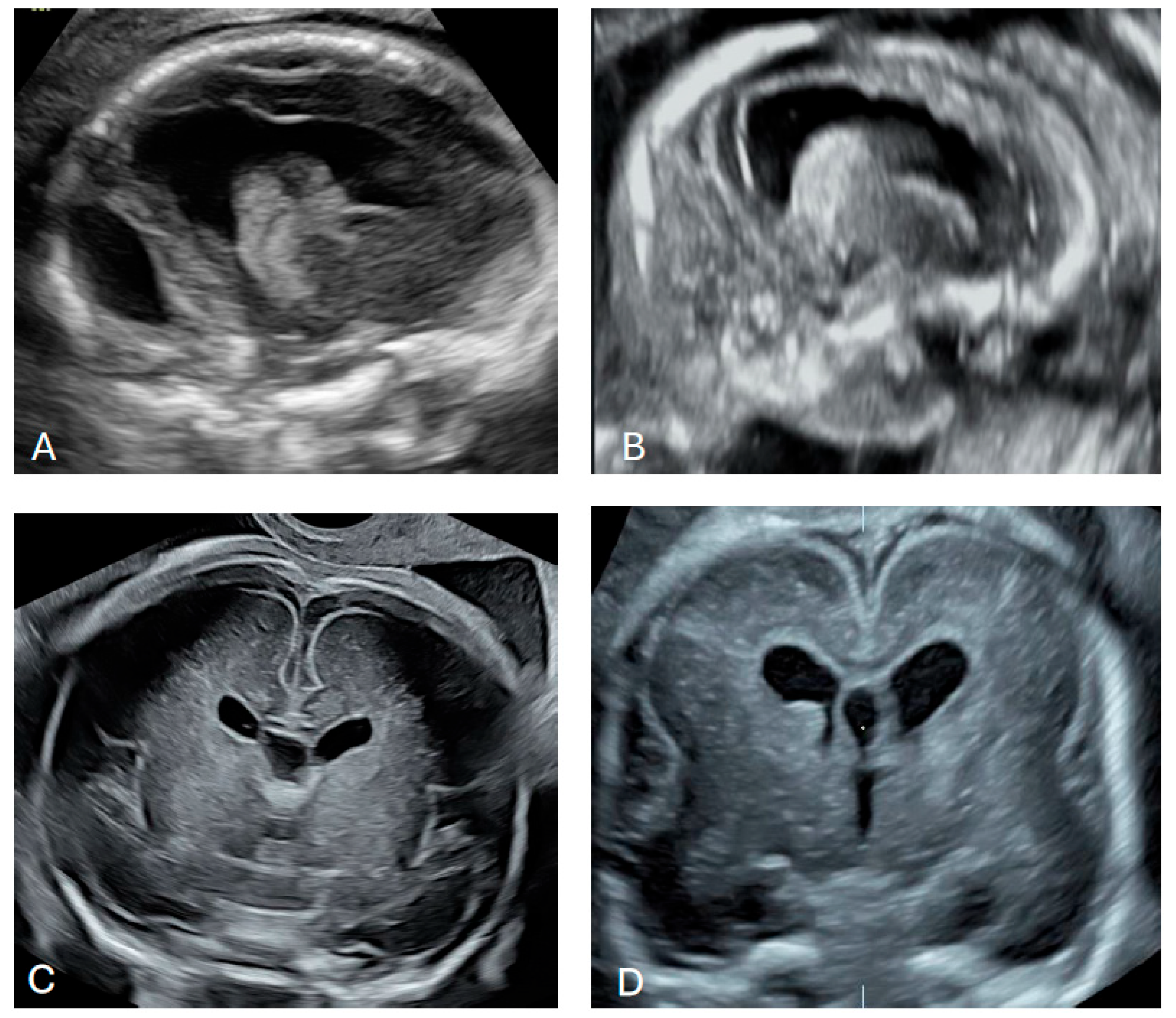 Diagnostics 16 01302 g007 Diagnostics 16 01302 g007