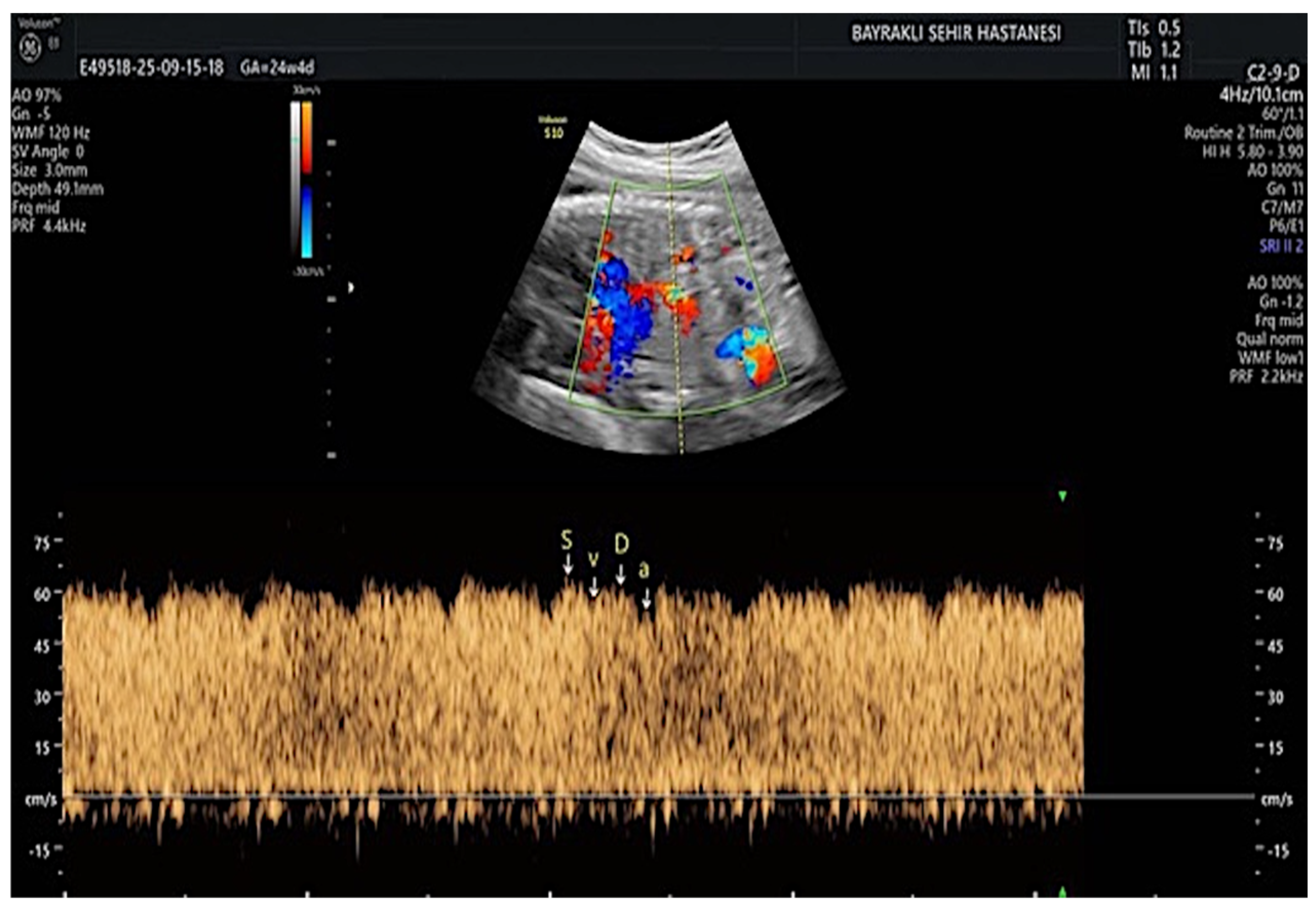 Diagnostics 16 01488 g001 Diagnostics 16 01488 g001