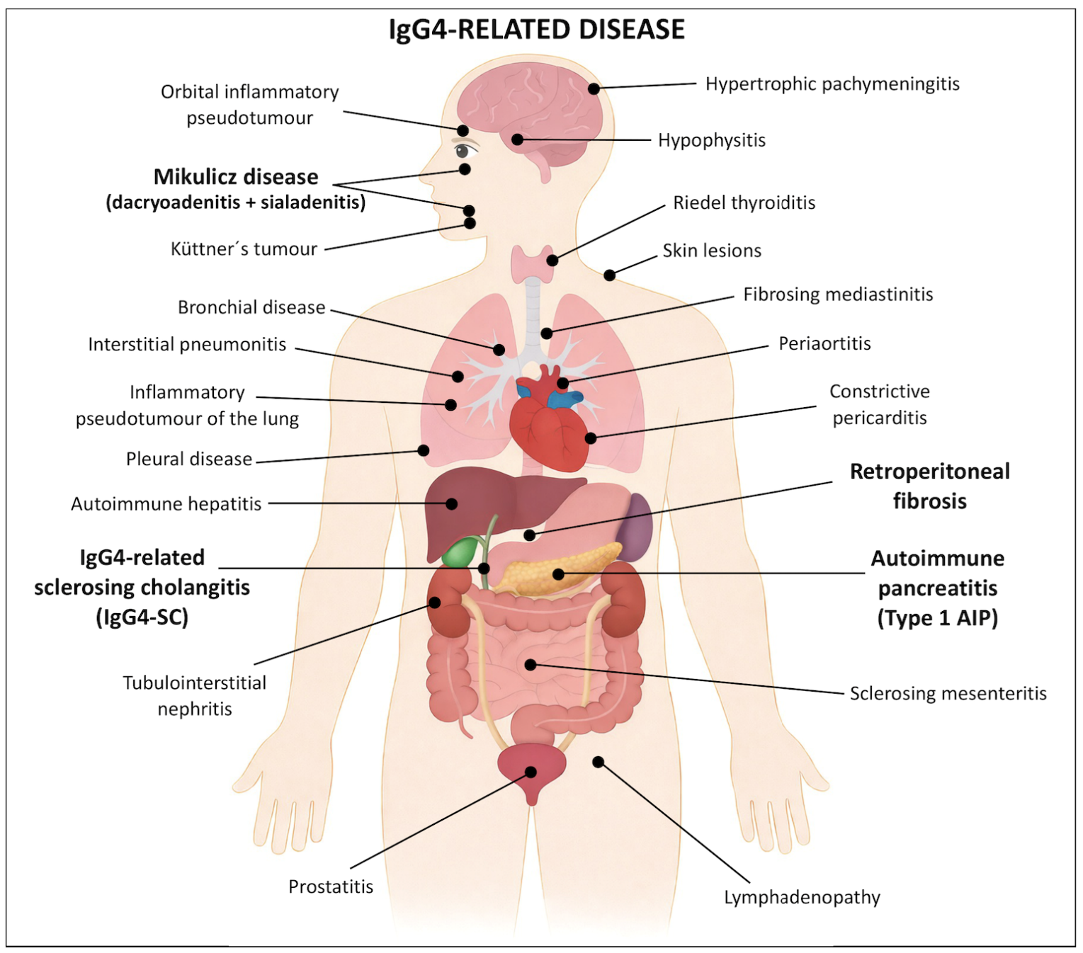 Diagnostics 16 01806 g001 Diagnostics 16 01806 g001