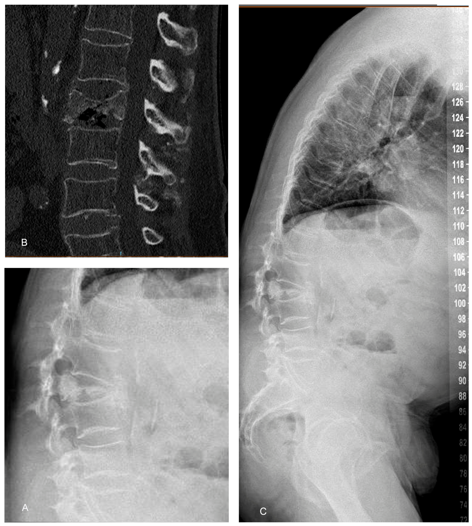 Diagnostics 16 01896 g003 Diagnostics 16 01896 g003