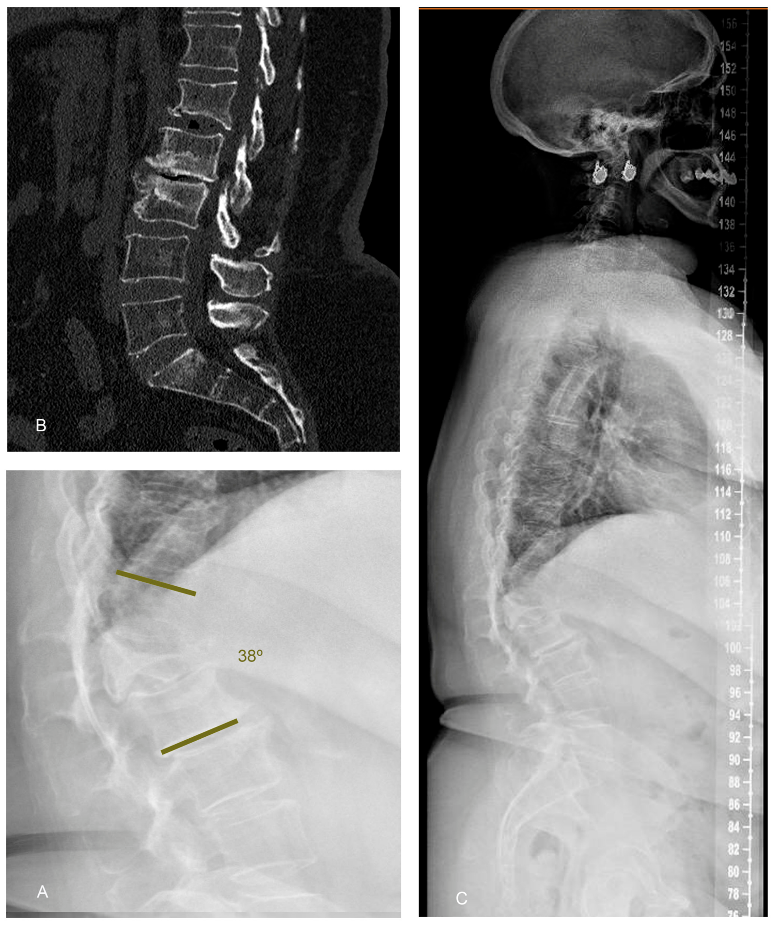 Diagnostics 16 01896 g004 Diagnostics 16 01896 g004