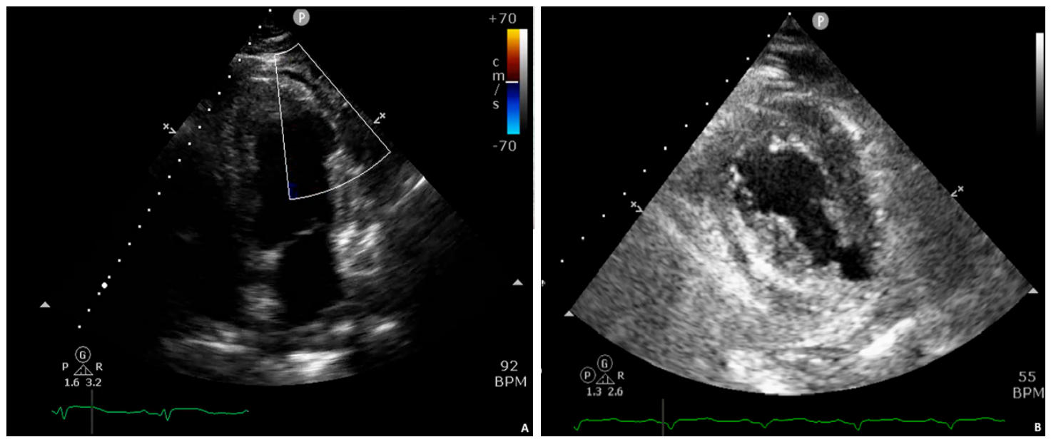 Diagnostics 16 01923 g003 Diagnostics 16 01923 g003