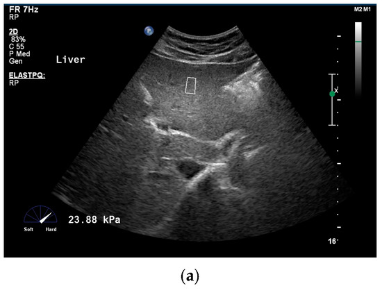 Diagnostics 16 02053 g001a Diagnostics 16 02053 g001a