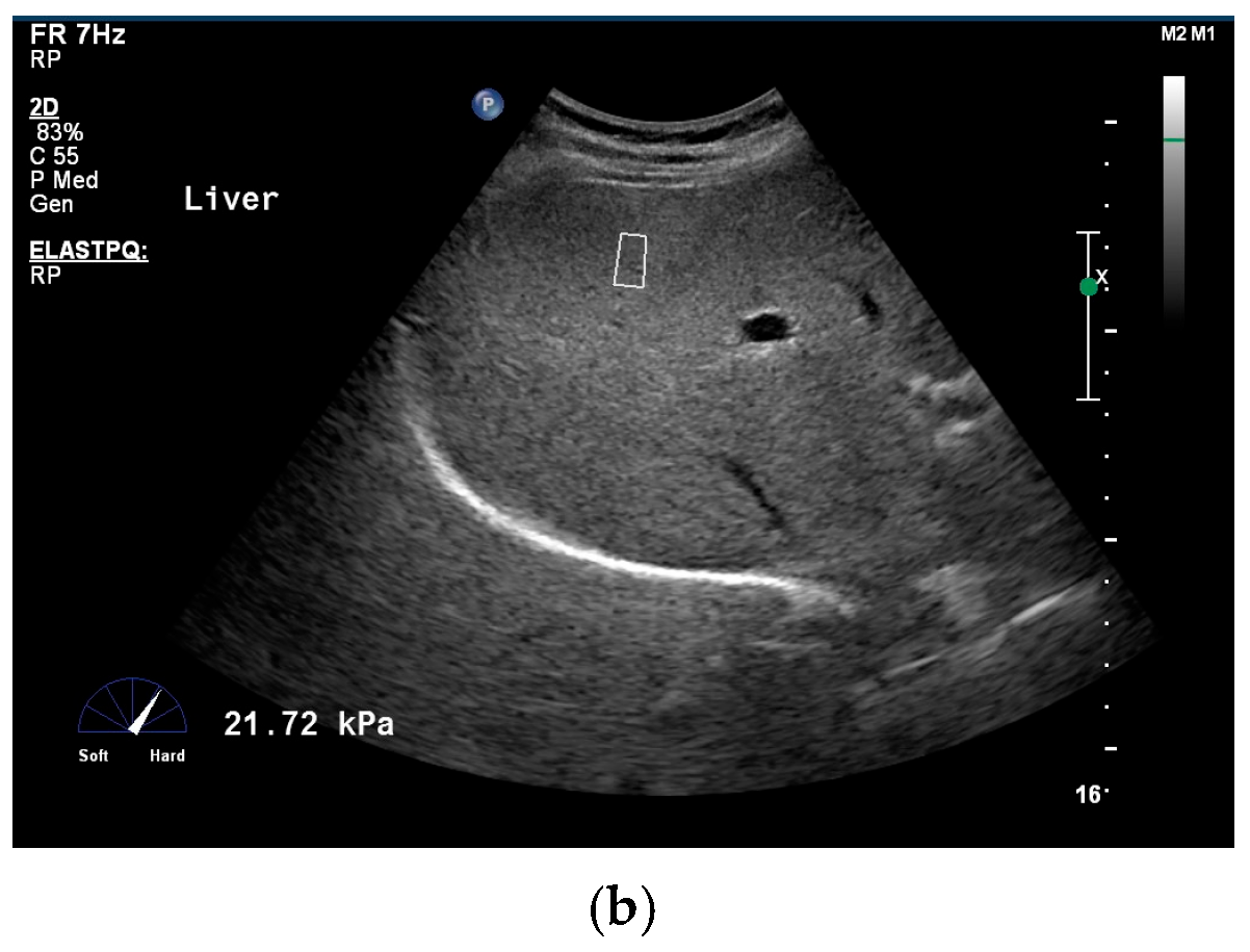 Diagnostics 16 02053 g001b Diagnostics 16 02053 g001b