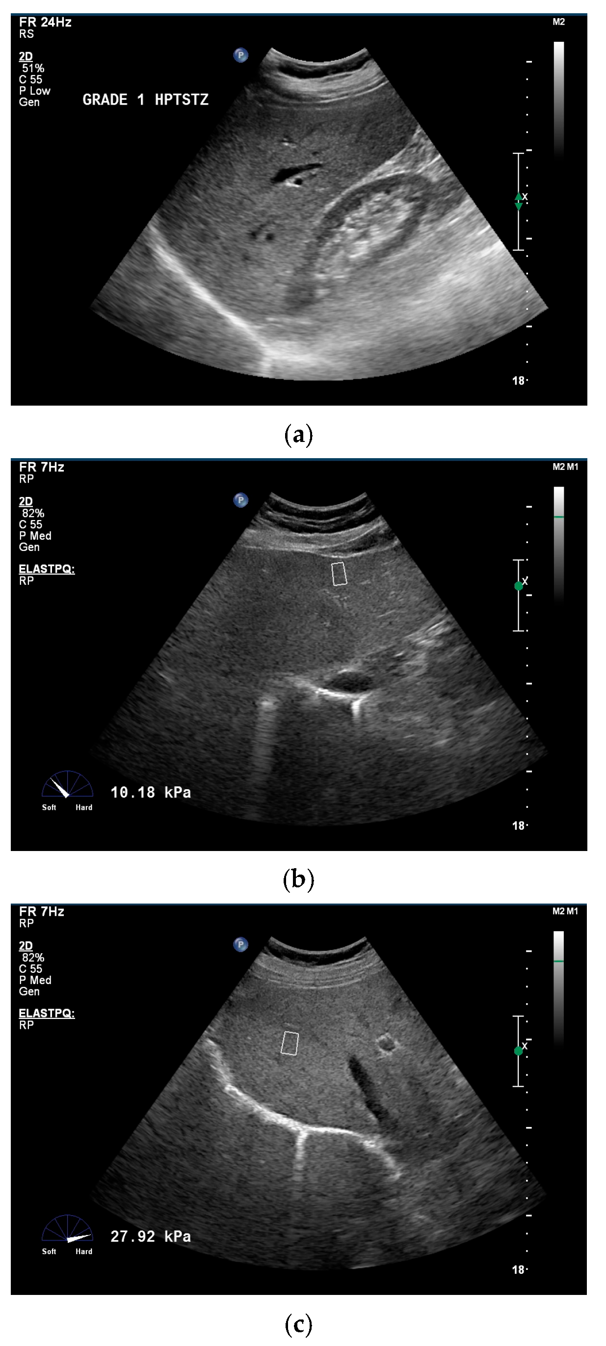 Diagnostics 16 02053 g002 Diagnostics 16 02053 g002