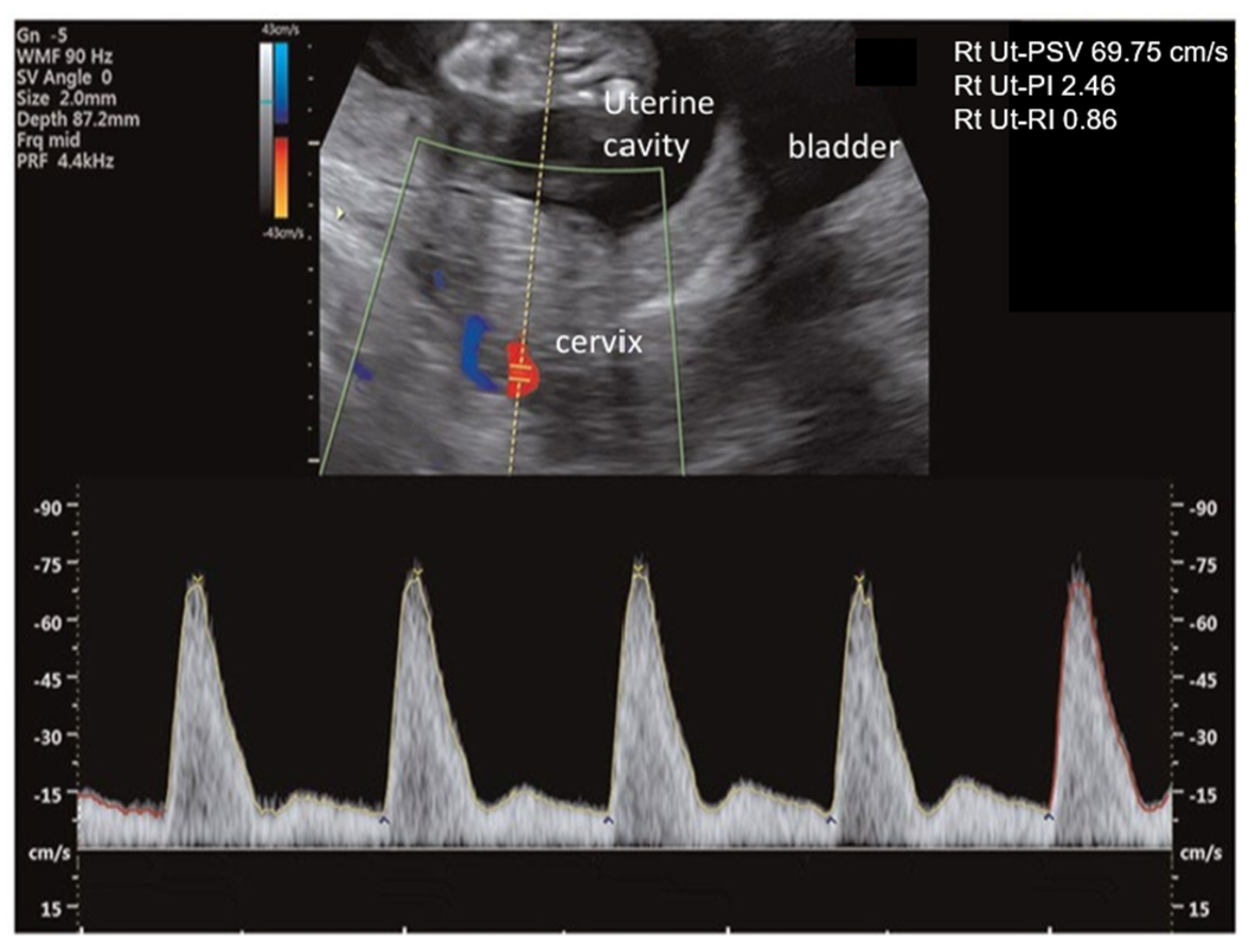 Diagnostics 16 02074 g002 Diagnostics 16 02074 g002