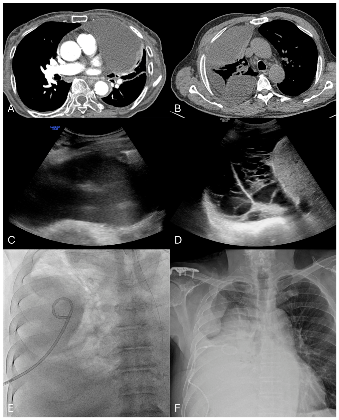 Diagnostics 16 02089 g002 Diagnostics 16 02089 g002