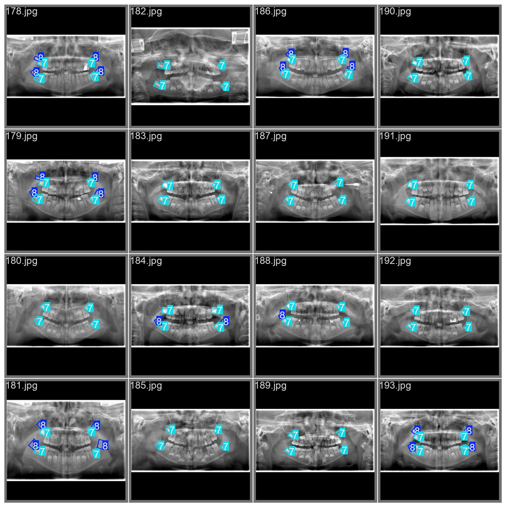 Diagnostics 16 02141 g007 Diagnostics 16 02141 g007