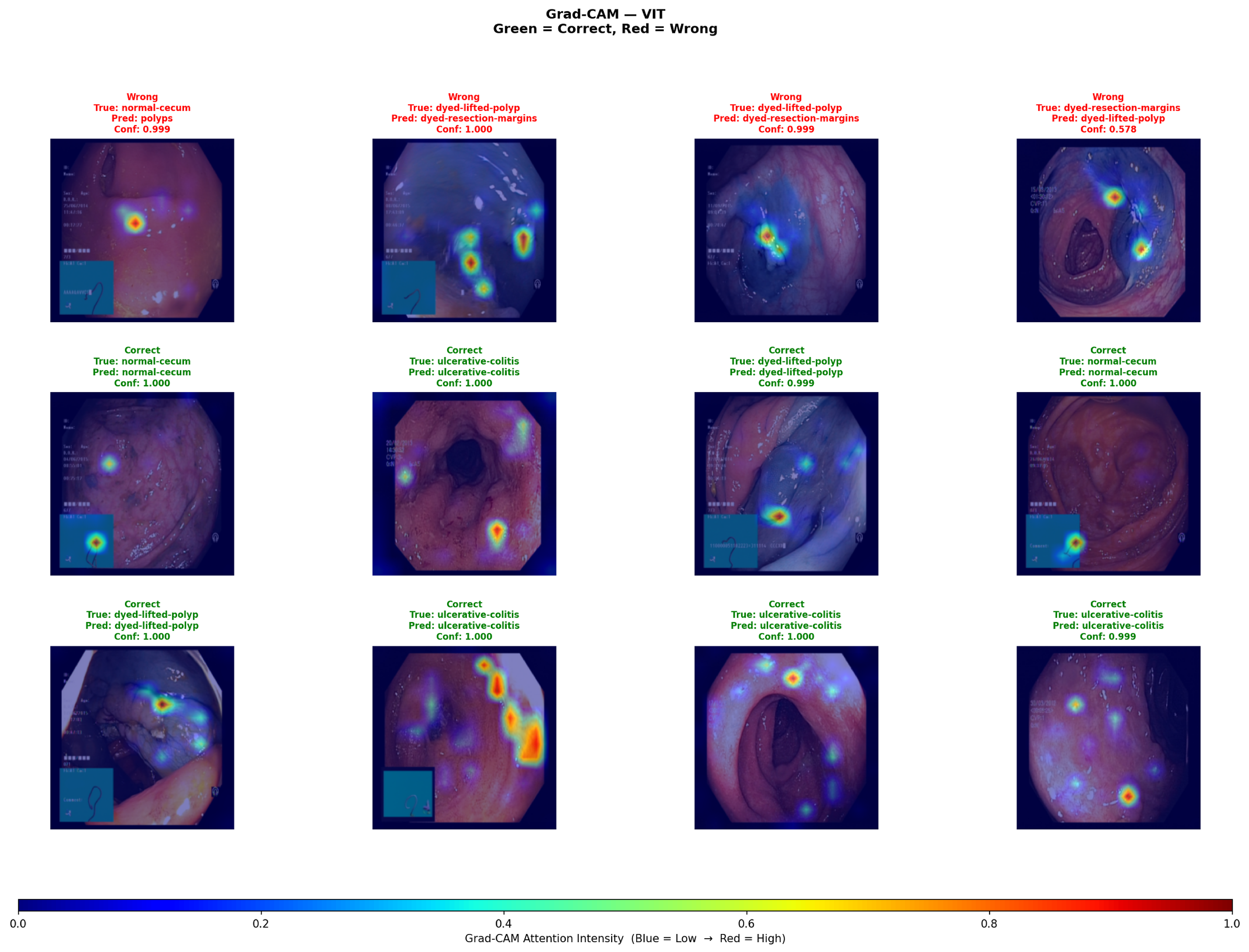 Diagnostics 16 02182 g007 Diagnostics 16 02182 g007