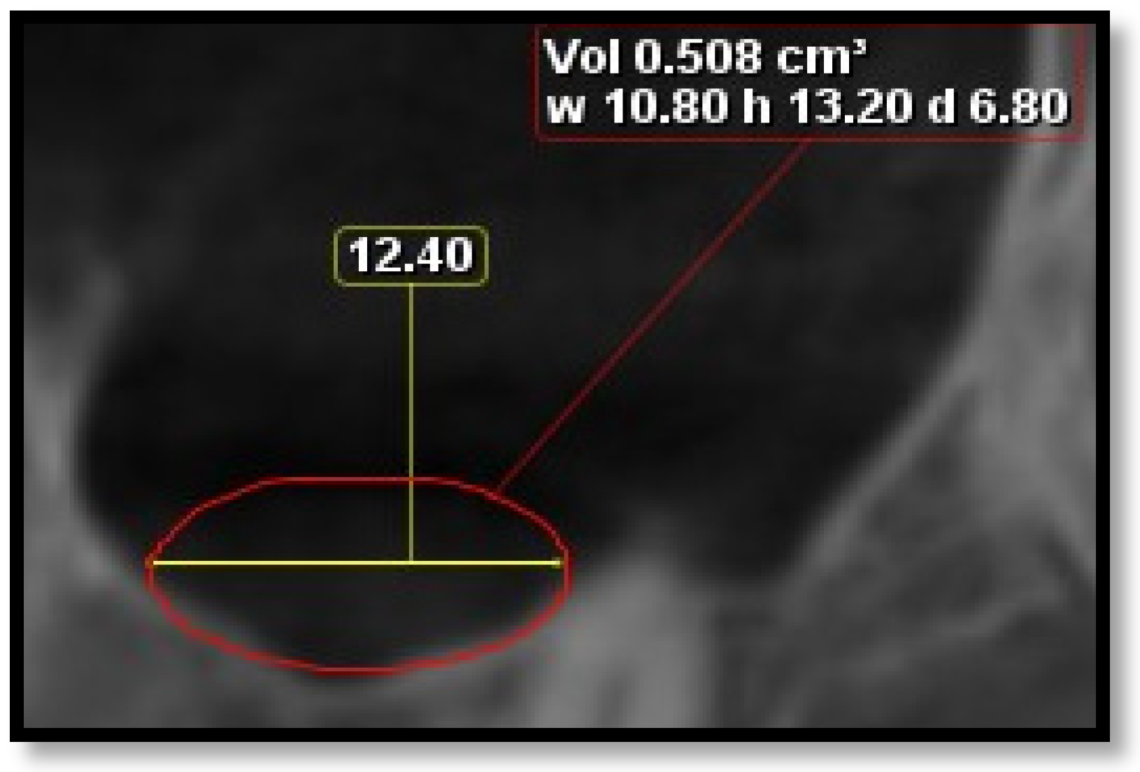 Diagnostics 16 02268 g002 Diagnostics 16 02268 g002