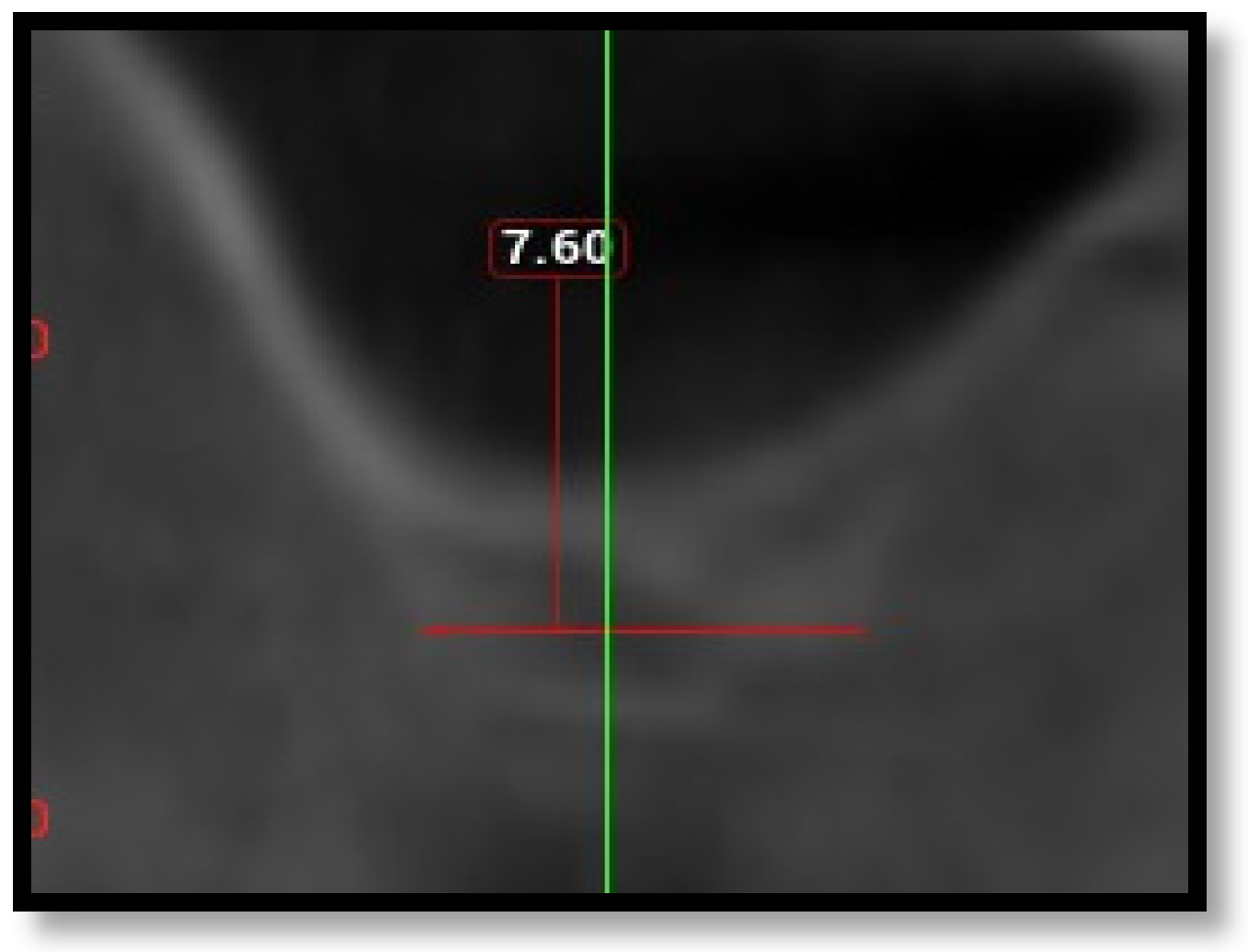 Diagnostics 16 02268 g003 Diagnostics 16 02268 g003