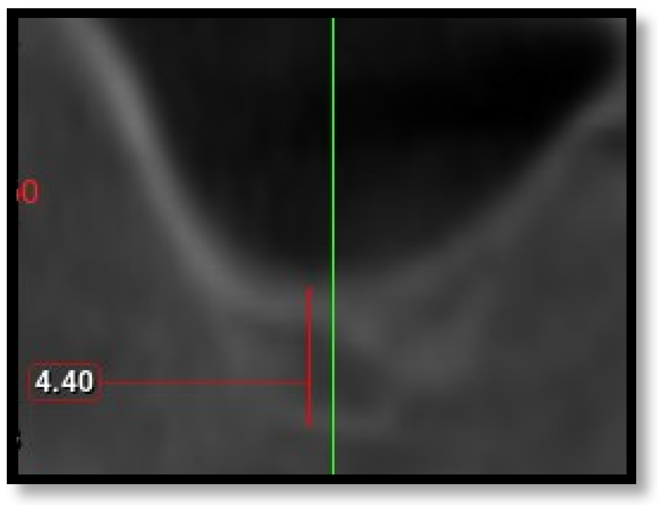 Diagnostics 16 02268 g004 Diagnostics 16 02268 g004