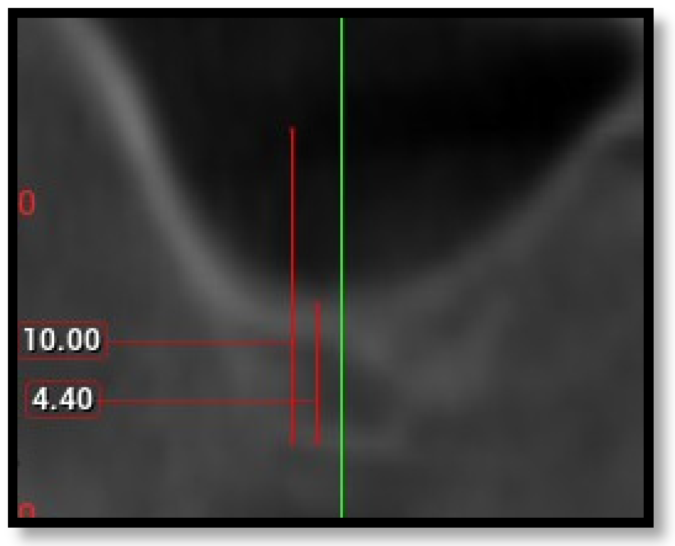 Diagnostics 16 02268 g005 Diagnostics 16 02268 g005