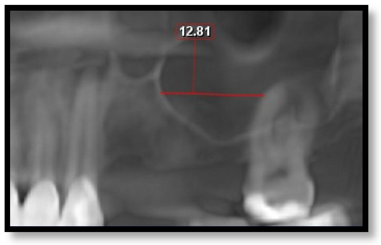 Diagnostics 16 02268 g006 Diagnostics 16 02268 g006
