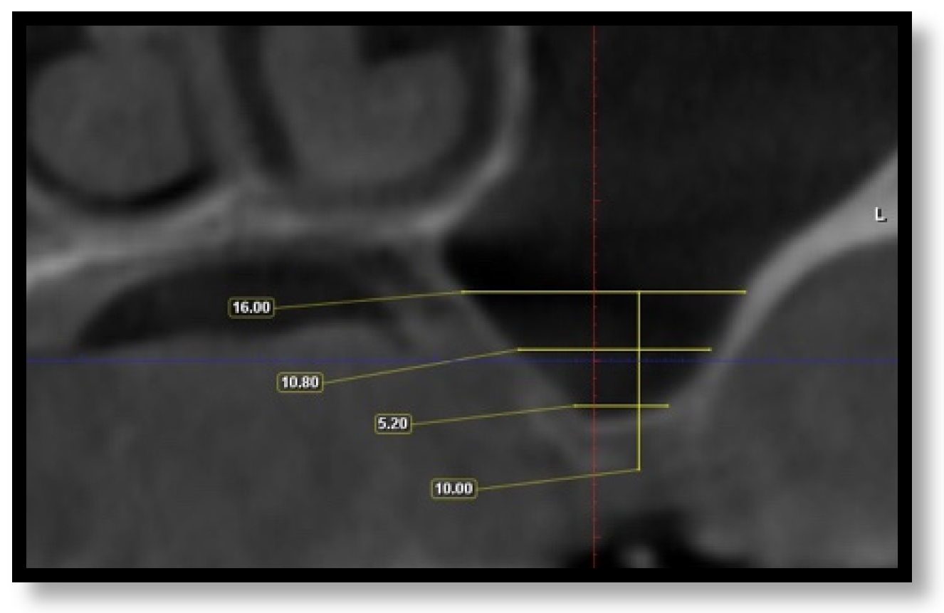 Diagnostics 16 02268 g007 Diagnostics 16 02268 g007