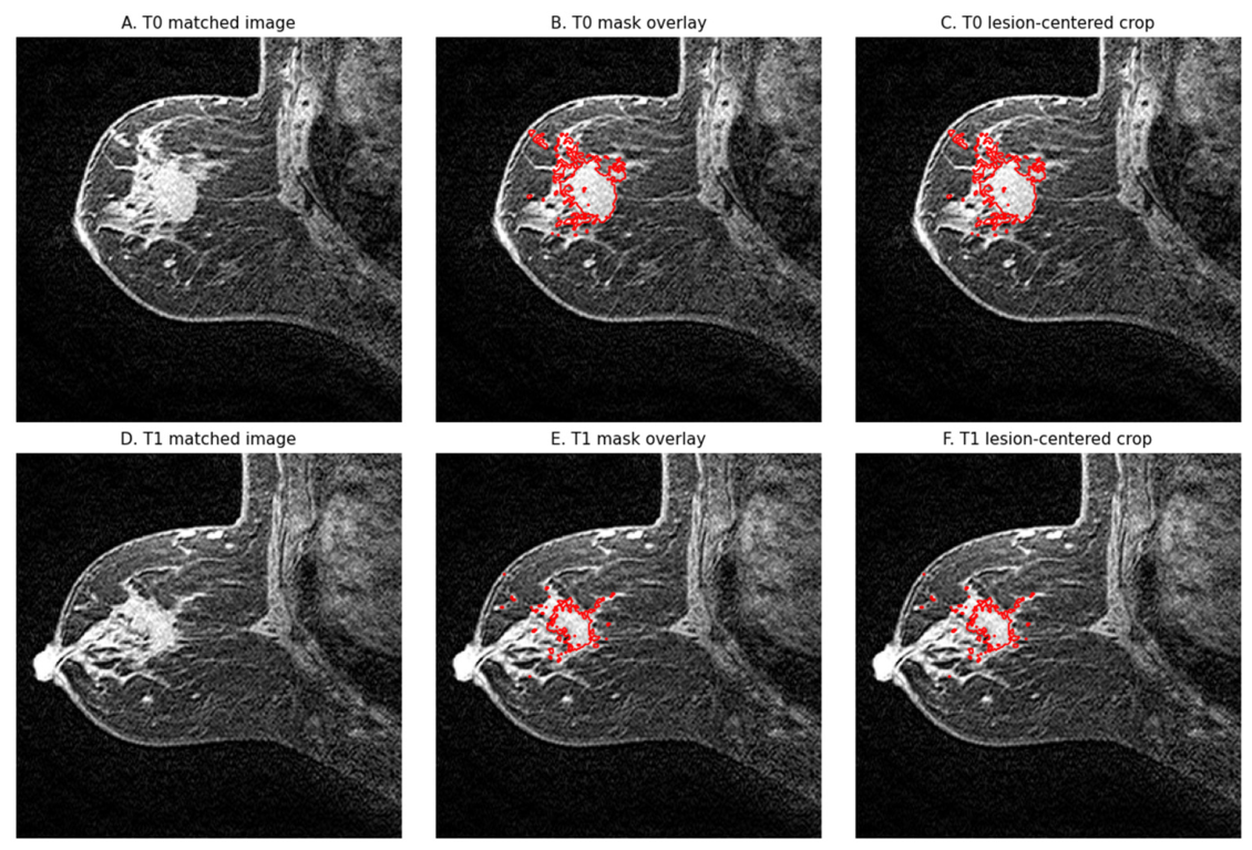 Diagnostics 16 02349 g002 Diagnostics 16 02349 g002