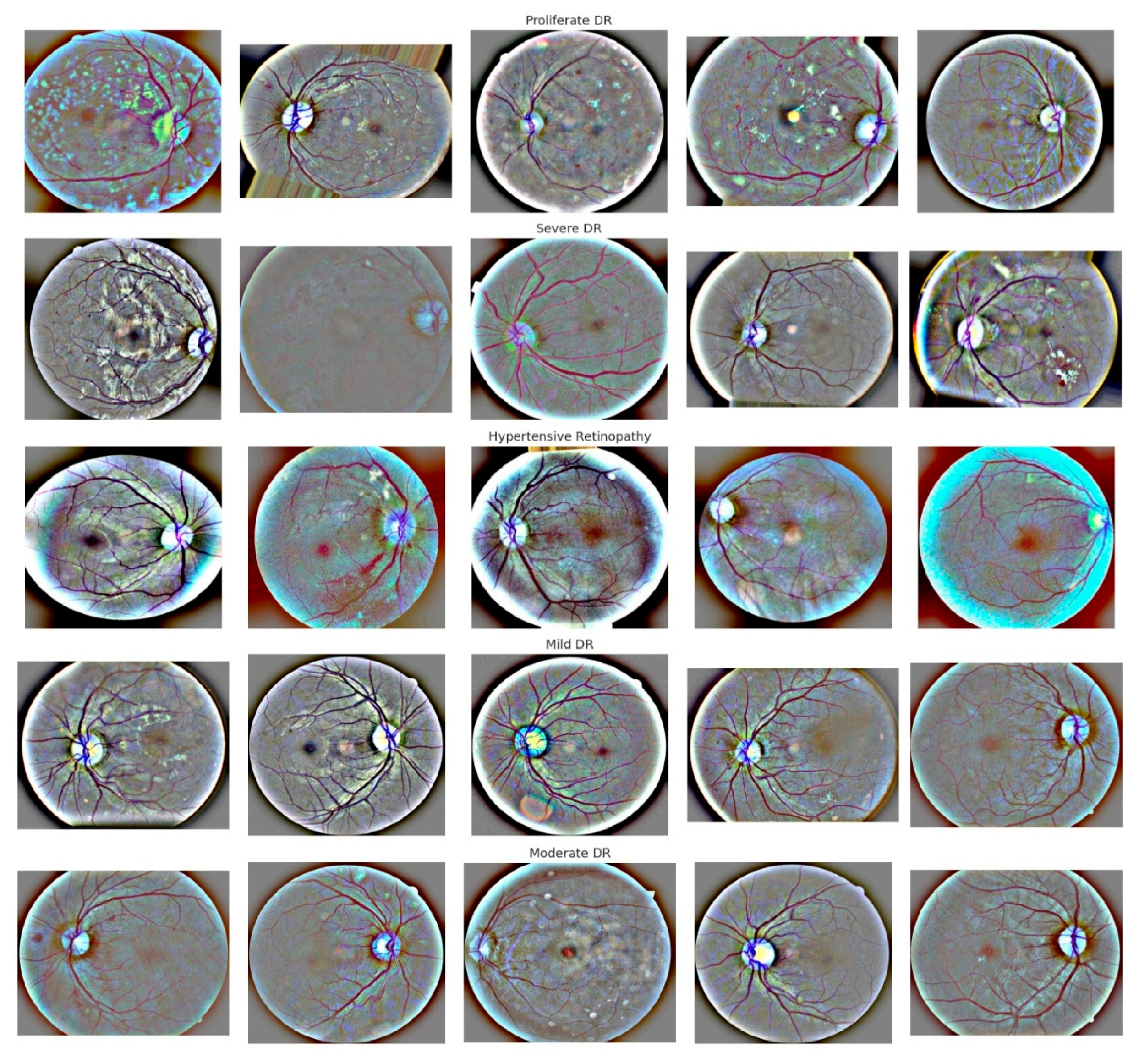 Diagnostics 16 03058 g004 Diagnostics 16 03058 g004