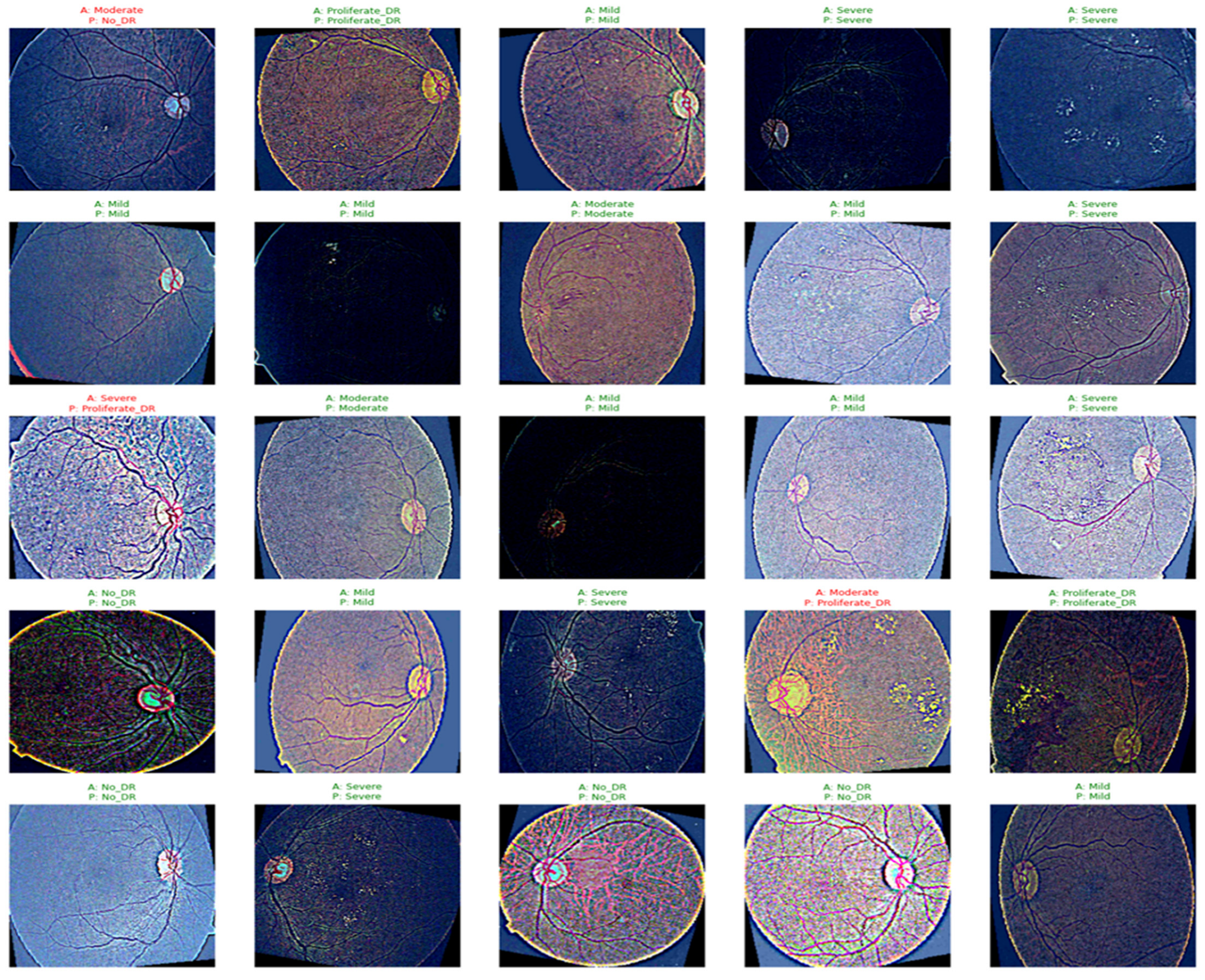 Diagnostics 16 03058 g006 Diagnostics 16 03058 g006