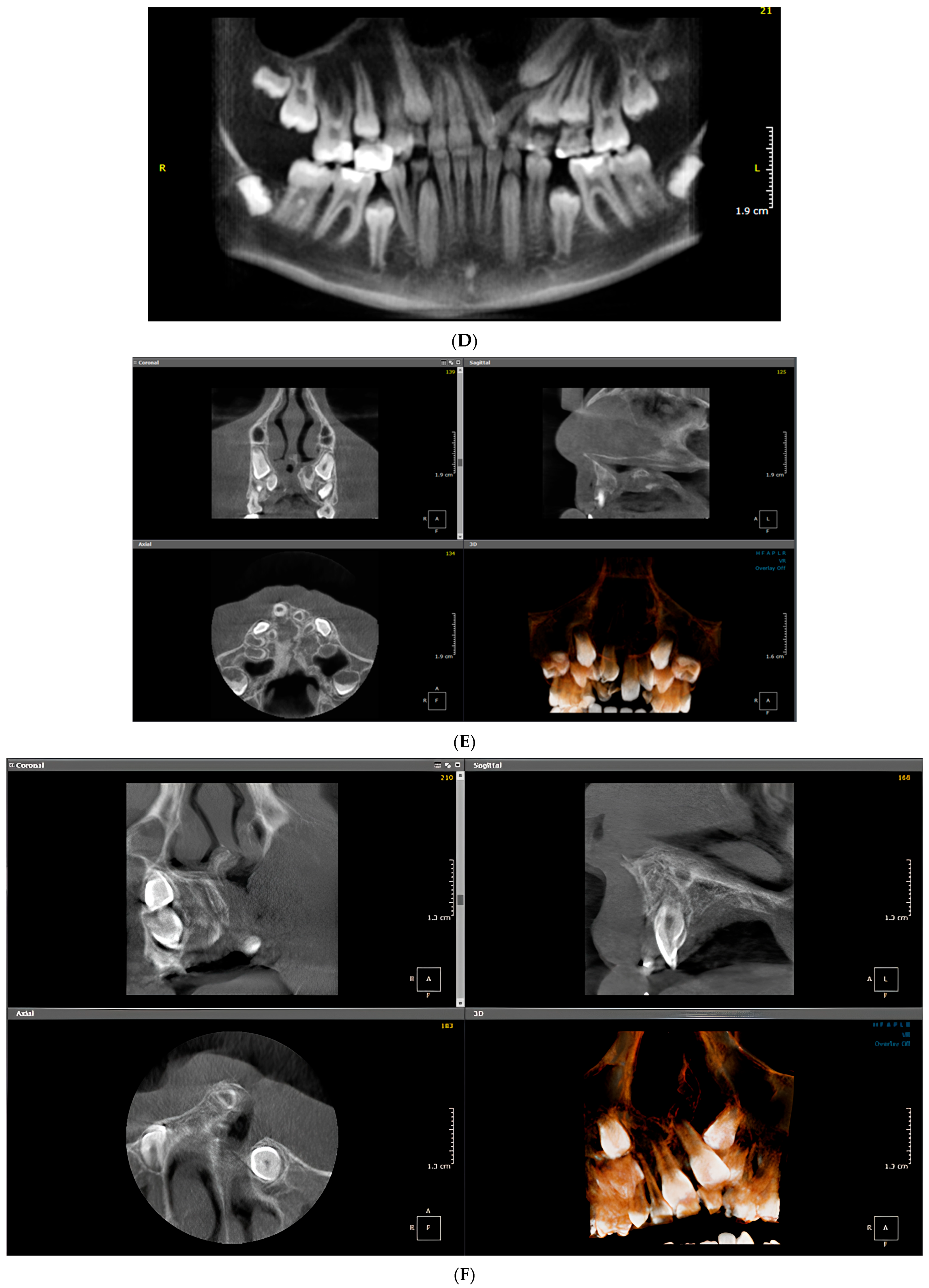 Diagnostics 16 03140 g002c Diagnostics 16 03140 g002c