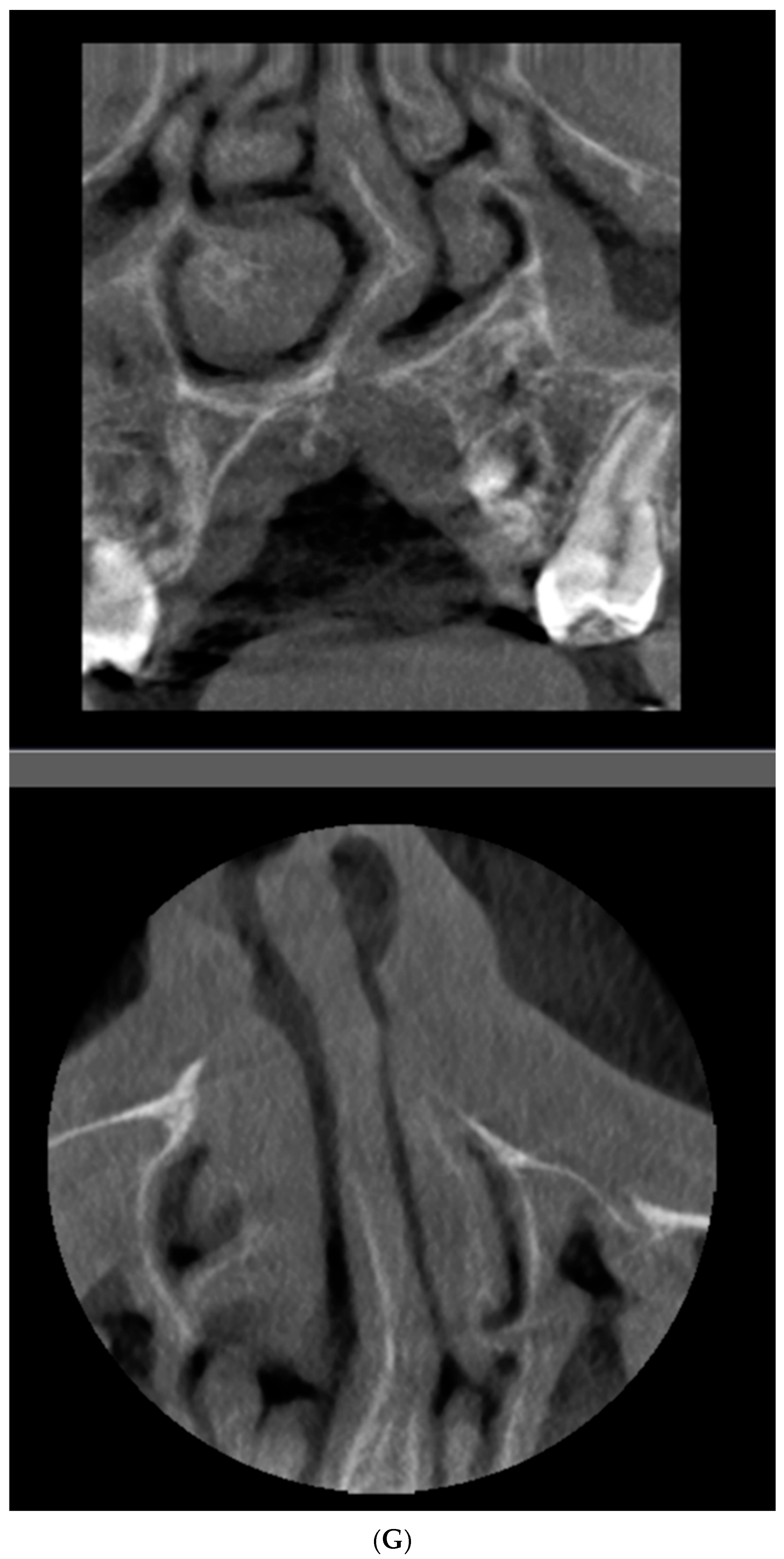Diagnostics 16 03140 g002d Diagnostics 16 03140 g002d