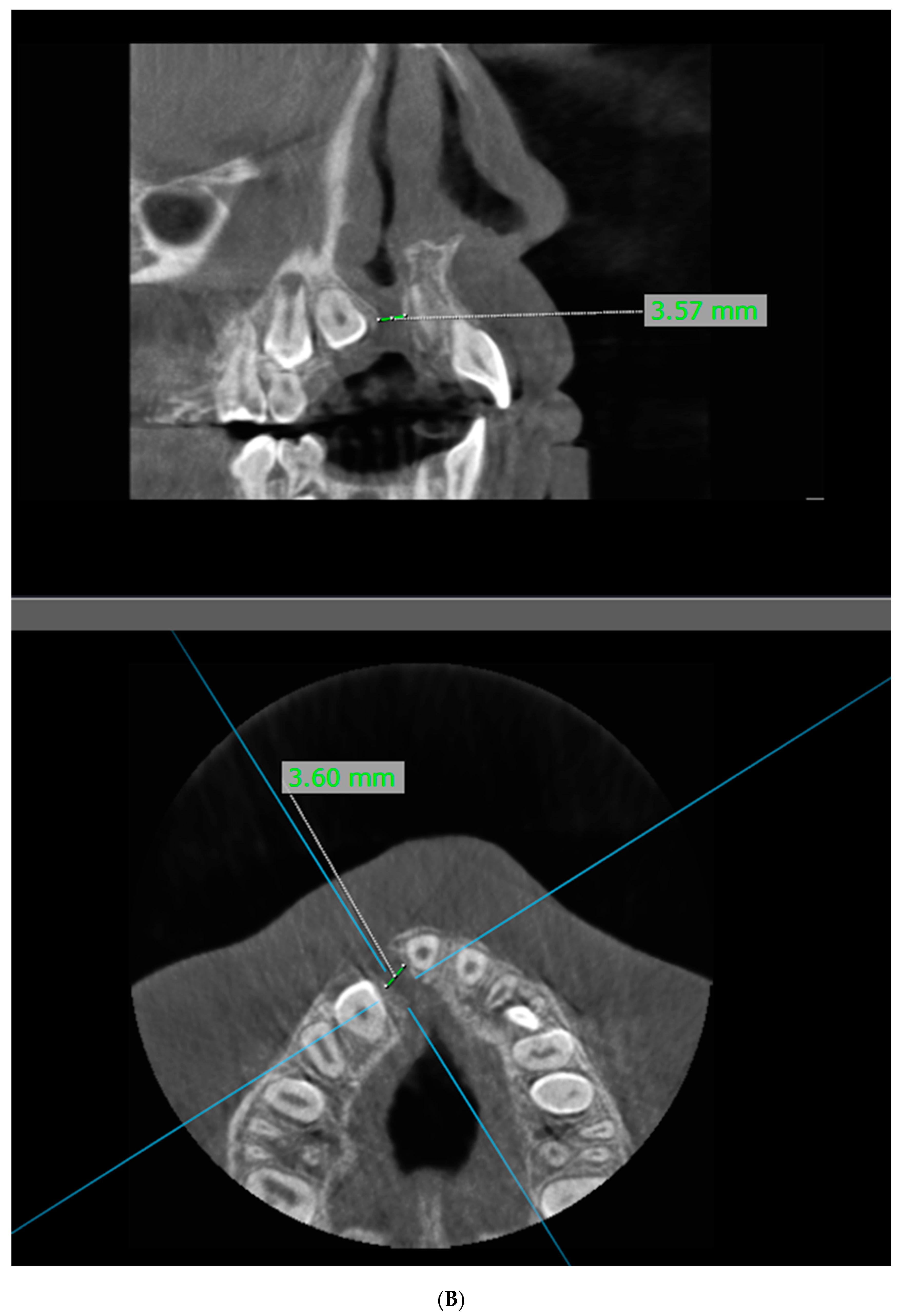 Diagnostics 16 03140 g003b Diagnostics 16 03140 g003b